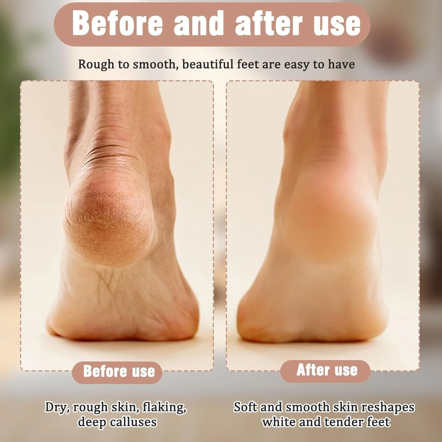 سوهان برقی پدیکور پا، ابزار پدیکور سوهان پا، مراقبت از پا برای پاشنه پا، پوست مرده سخت و ترک خورده، کیت مراقبت از پا با نمایشگر باتری