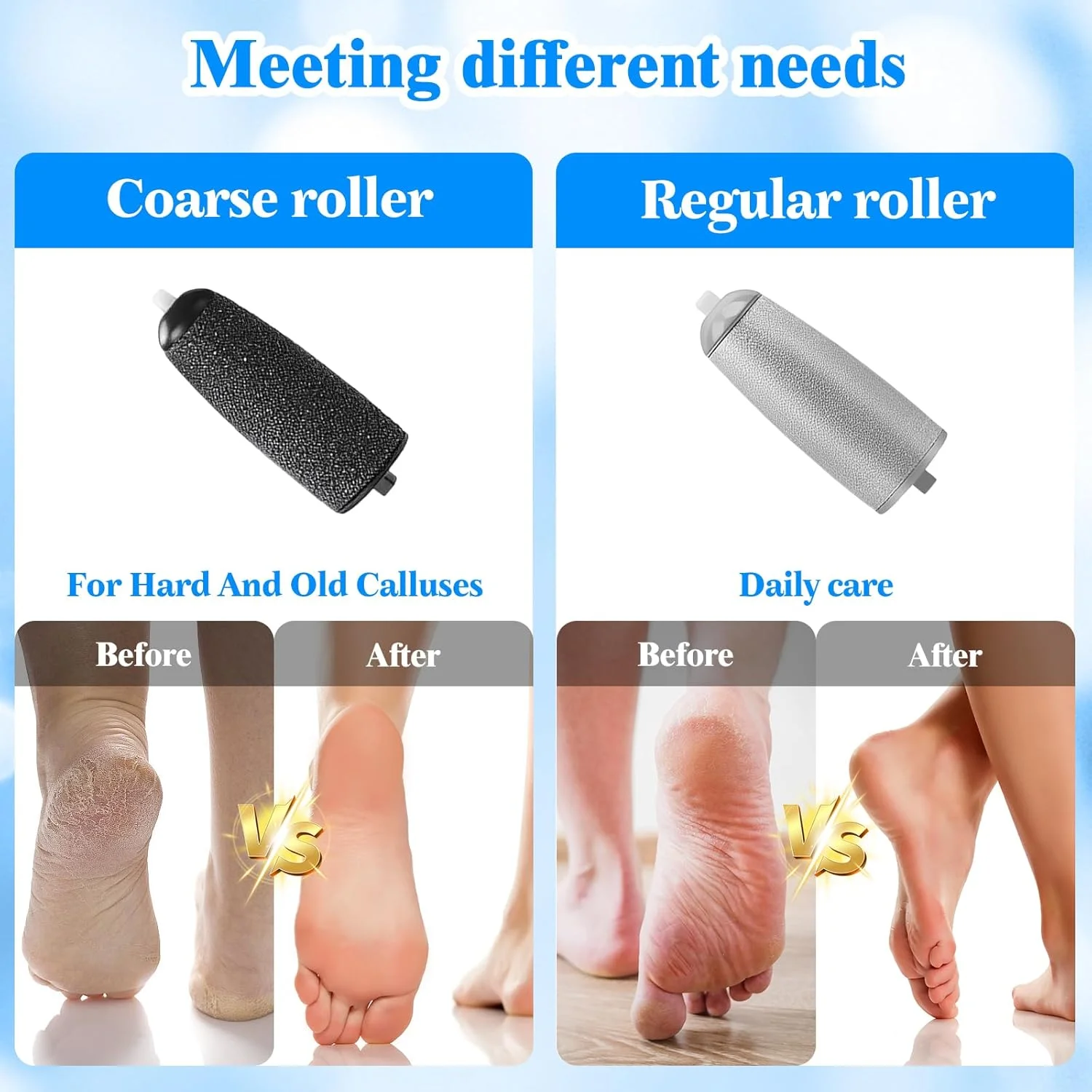 سوهان برقی پینه پا، سوهان برقی پا، دارای کابل شارژ USB، 4 سوهان قابل تعویض، ست پدیکور، مراقبت از پا، برقی، 3 سرعت، سفید