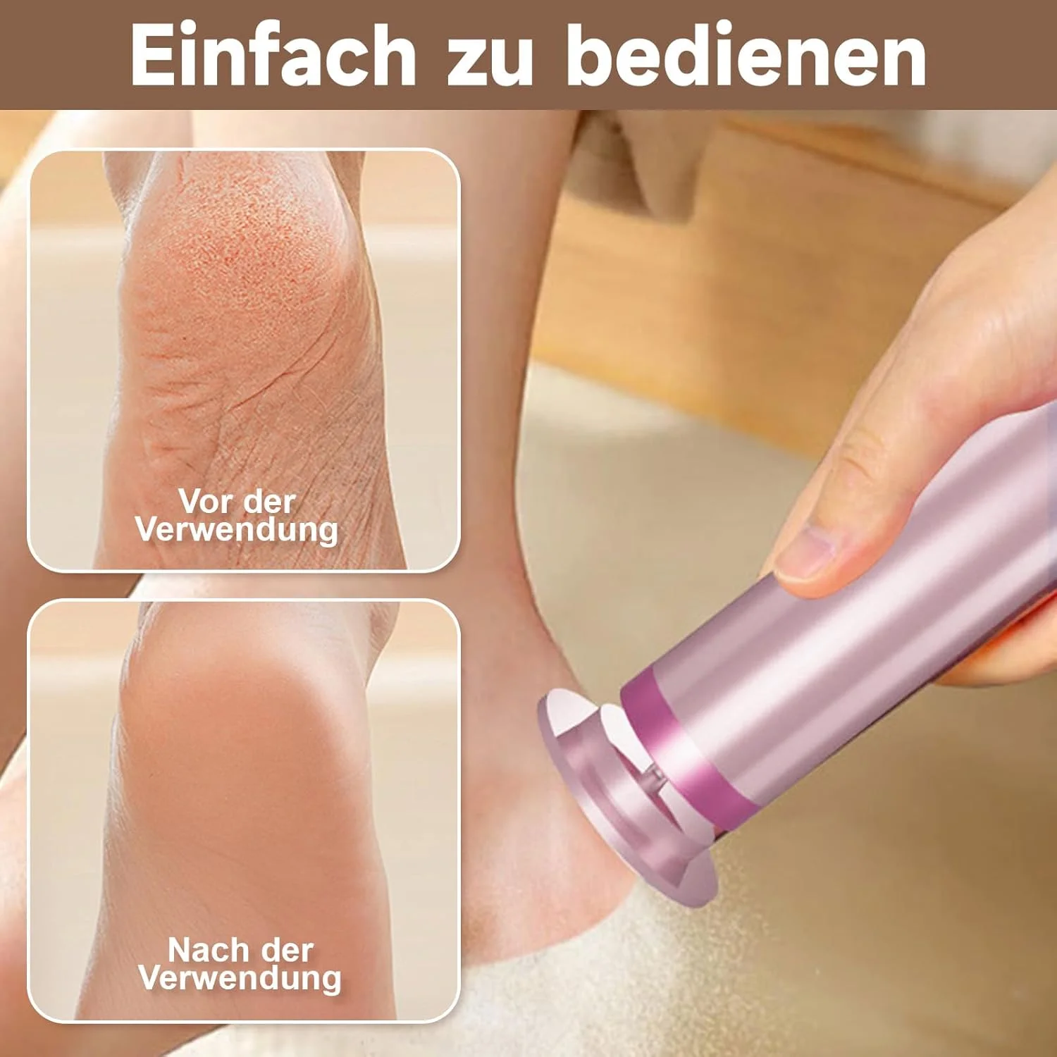 2-in-1 Electric Callus Remover for Feet, 9 Speeds Adjustable with Battery Indicator, Callus Removal Foot Pedicure Set with Sanding Disc for Dry and Cracked People (Pink)