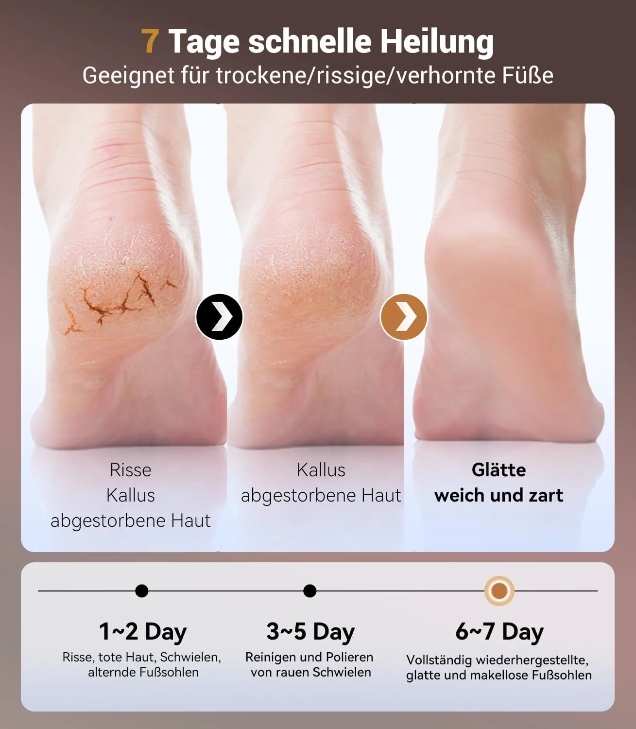 سوهان برقی پینه LOZLTX، بدون پینه/بدون ترک، سوهان برقی پا، فناوری حسگر پا، برای پوست های ترک خورده و سفت (طلایی)