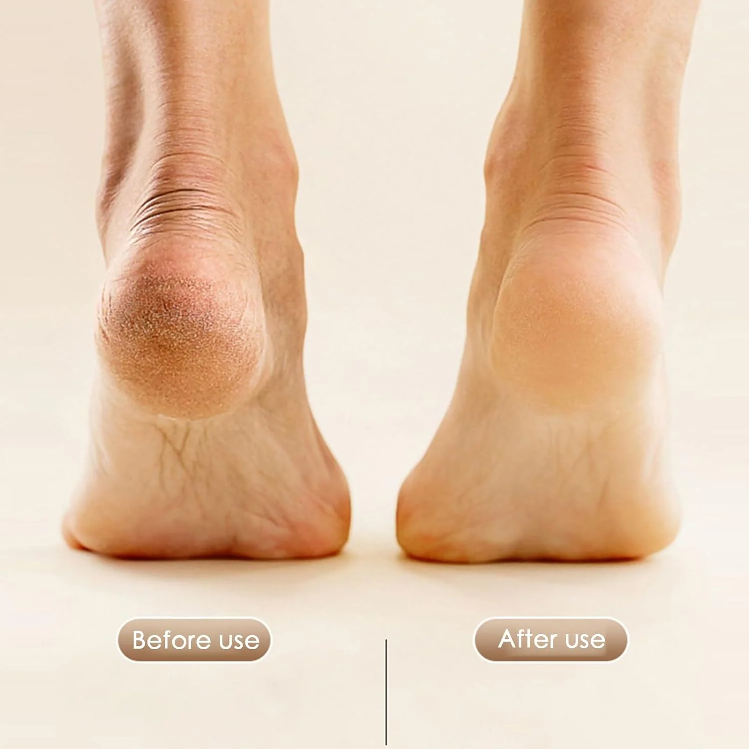 Electric Feet Callus Remover, 2-speed Foot File Electric, USB Charging Digital Display Automatic Scrubber For Dry Heels