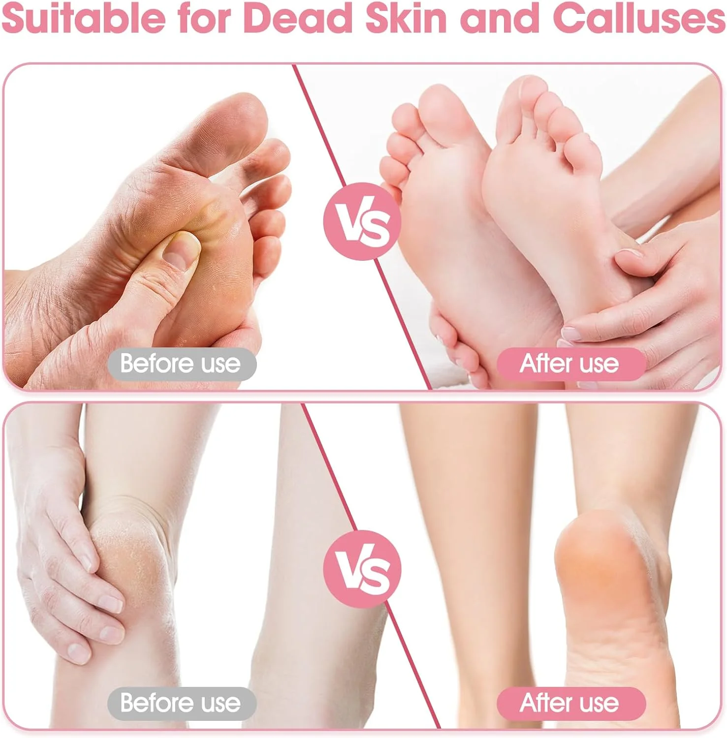 سوهان برقی پا برای از بین بردن پینه، سوهان برقی ارتقا یافته پا، سوهان پدیکور با سرعت قابل تنظیم به همراه 60 عدد دیسک سمباده برای پوست های مرده، خشک و ترک خورده، پوست سخت و پینه (صورتی)