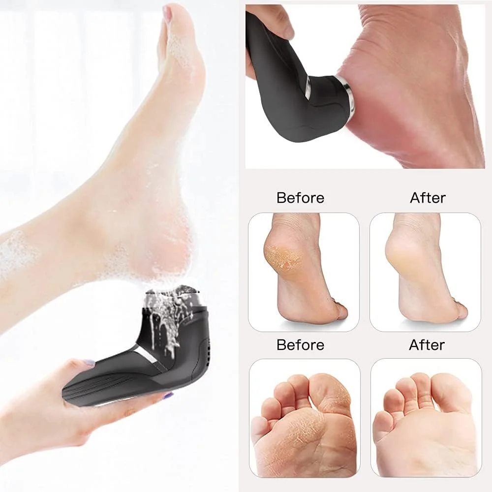 سوهان برقی پا، دستگاه حذف کننده پوست سفت شارژی، سنگ پا ضد آب برای پاشنه های ترک خورده، پینه ها و پوست های مرده با 3 سری سنگ زنی، 2 سرعت و 1 برس، نمایشگر باتری مدل MT-510 مشکی