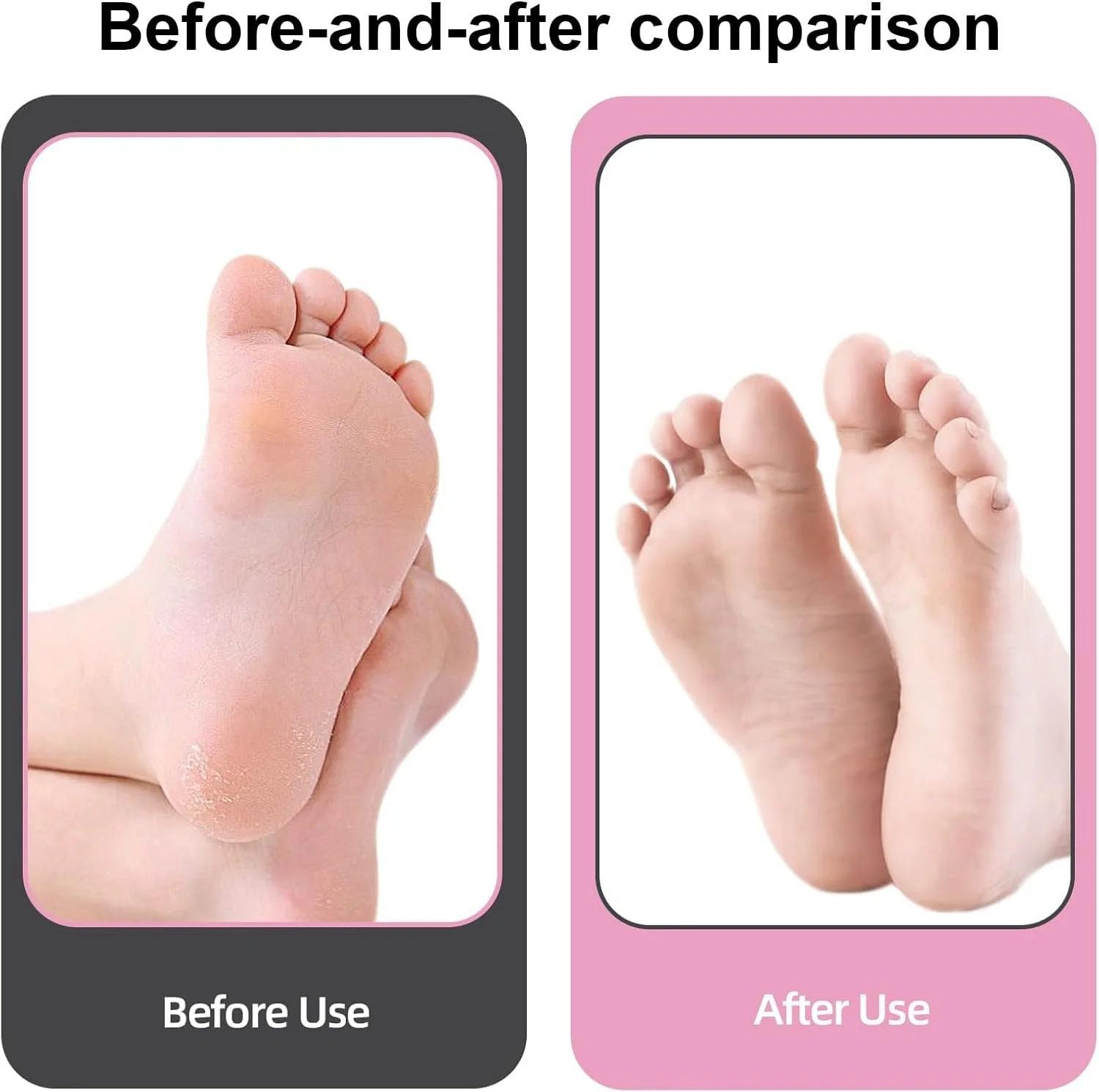 سوهان برقی پا (همراه با جاروبرقی پوست مرده)، کوارتز، ابزار پدیکور شارژی پا، سوهان پا، کیت مراقبت حرفه ای پا، از بین برنده پوست مرده با 3 سری و 2 سرعت، نمایشگر LCD سوهان برقی پا (همراه با جاروبرقی پوست مرده)، کوارتز، ابزار پدیکور شارژی پا، سوهان پا، کیت مراقبت حرفه ای پا، از بین برنده پوست مرده با 3 سری و 2 سرعت، نمایشگر LCD