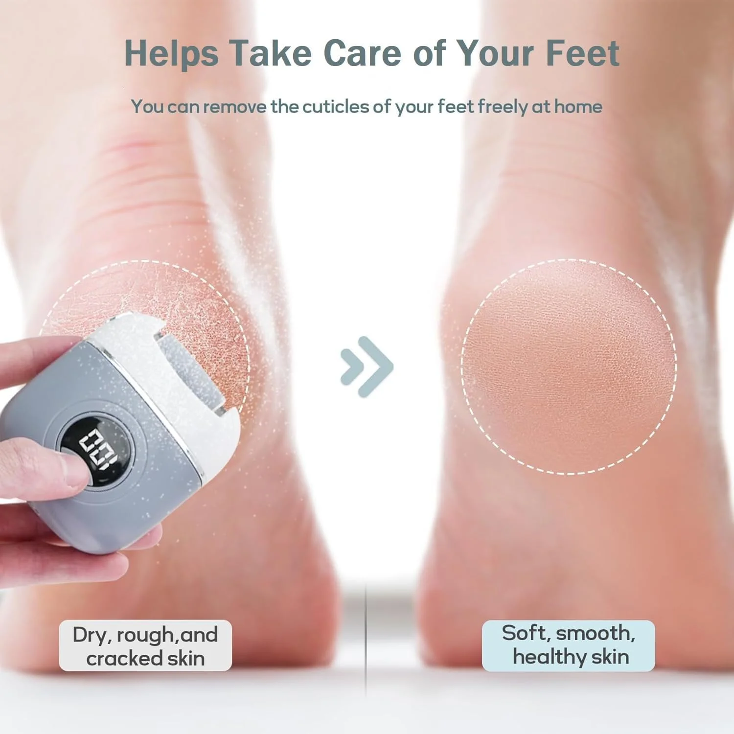 سوهان برقی پا، از بین برنده حرفه ای پینه پا، قابل شارژ USB، ضد آب، از بین برنده پوست سخت پا با 3 غلتک و 2 سرعت، ابزار پدیکور قابل حمل برای پاهای دارای پاشنه ترک خورده (خاکستری)