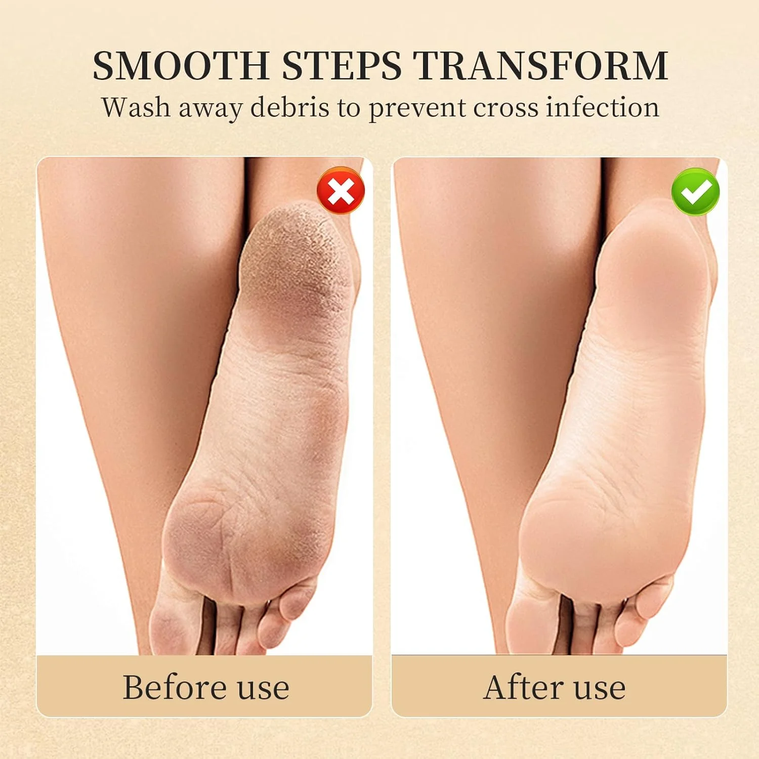 سوهان برقی حرفه ای پا - سوهان برقی پا، ضد آب IPX7، شارژ USB، 2 سرعت، نشانگر LED برای پاشنه های ترک خورده، پوست مرده و مراقبت از پا (سفید)