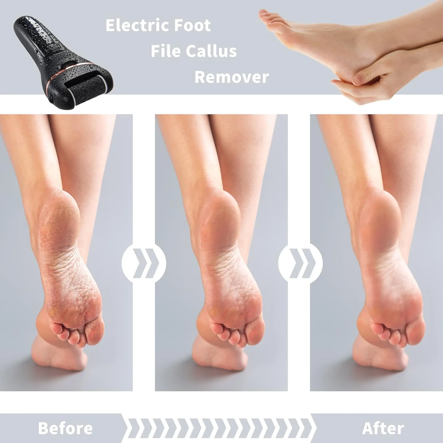 سوهان برقی پا Bemece، کیت حرفه ای پدیکور قابل شارژ و ضد آب با مجموعه ابزار پدیکور 10 در 1 برای پاشنه های ترک خورده، پینه ها و پوست های مرده (مشکی)