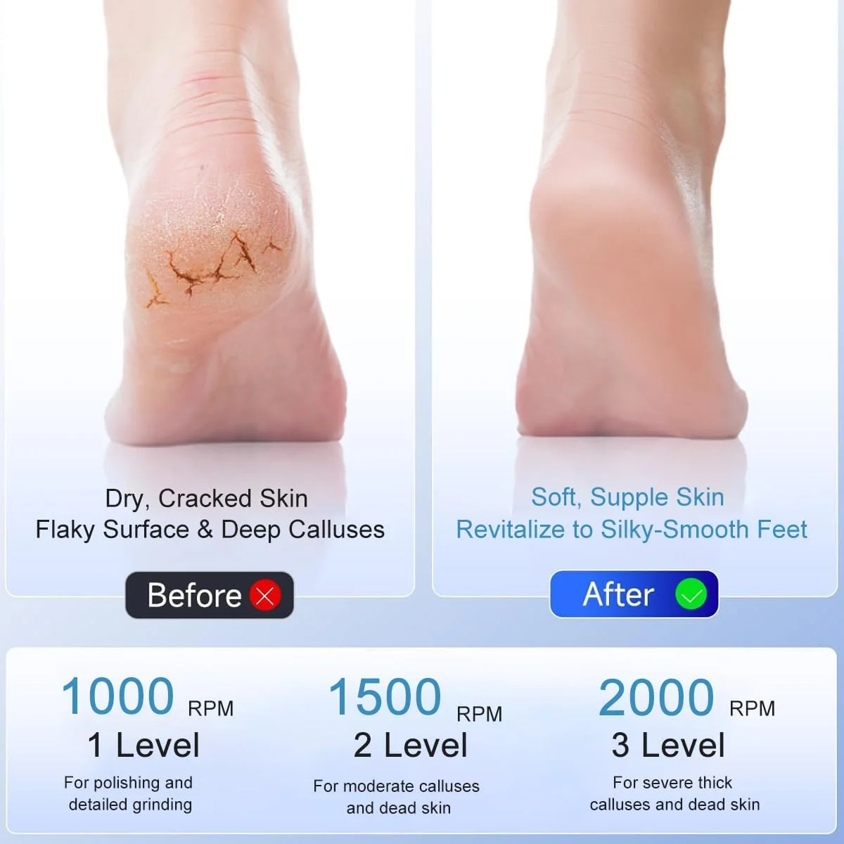 HANNEA® Electric Foot Callus Remover, Professional 3 Speed Rechargeable Pedicure Tool with Stainless Steel Roller Head, Pressure Sensor & LED Display for Cracked Heels, Dead Skin, Hard Calluses