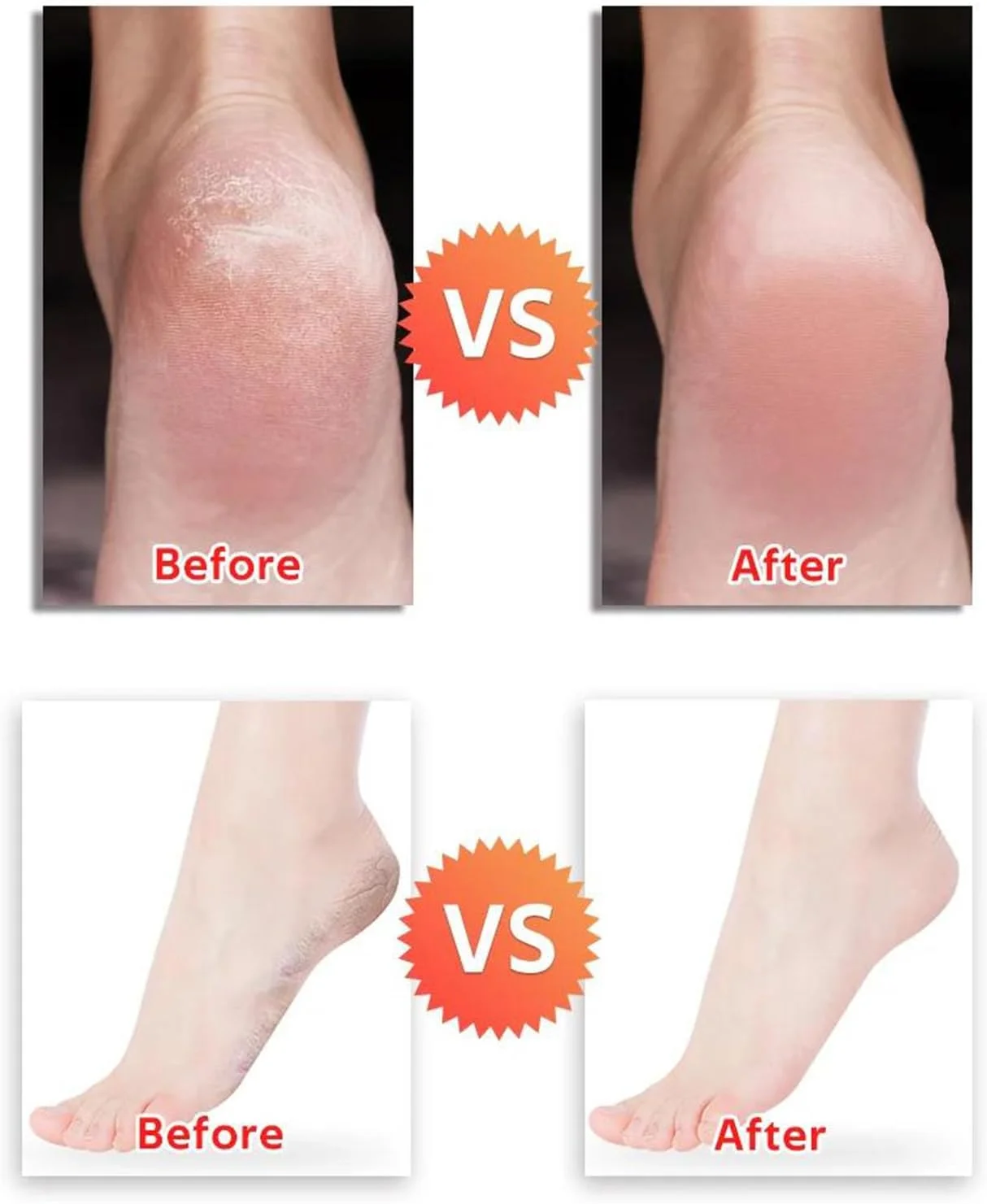 دستگاه از بین برنده پینه برقی پا Dermave، ابزار حرفه ای پدیکور، از بین برنده پینه، سوهان برقی پا با سرعت قابل تنظیم برای از بین بردن پوست مرده مردان و زنان به همراه 60 سمباده قابل تعویض (رزگلد)