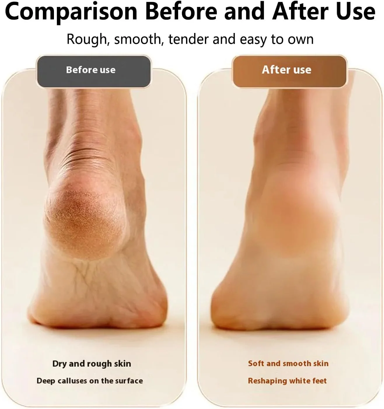 Electric Foot Callus Remover, Portable Electric Foot Files with 3 Heads & 2 Speeds, Rechargeable Foot Grinder, Waterproof Deadskin Remover, Pedicure Tools for Dead, Hard Cracked Dry Skin (Blue)