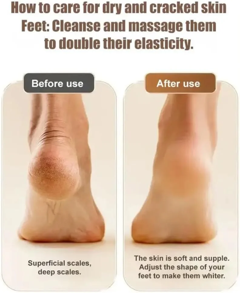 سوهان برقی دیجیتال جدید پا 2024، از بین برنده پوست مرده پا، لایه بردار و سنگ پا، ابزار مراقبت از پا، سنگ پای برقی اتوماتیک (زرد)