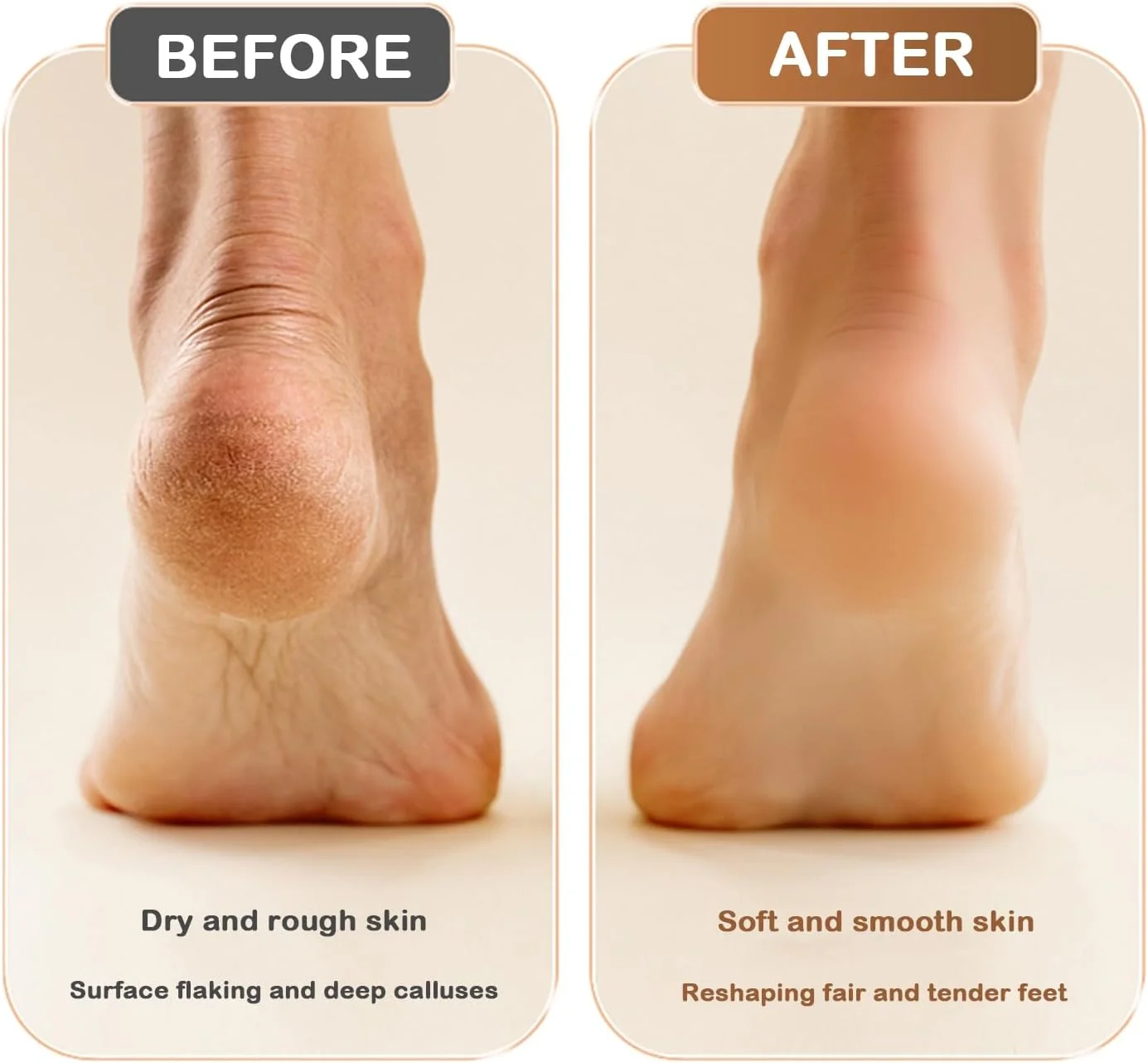 سوهان برقی پا، از بین برنده پینه پا، کیت پدیکور مراقبت از پا، اسکرابر پا، از بین برنده پوست مرده، قابل شارژ با 3 سری سنگ زنی 2 سرعته برای آقایان و بانوان - سفید سوهان برقی پا، از بین برنده پینه پا، کیت پدیکور مراقبت از پا، اسکرابر پا، از بین برنده پوست مرده، قابل شارژ با 3 سری سنگ زنی 2 سرعته برای آقایان و بانوان - سفید