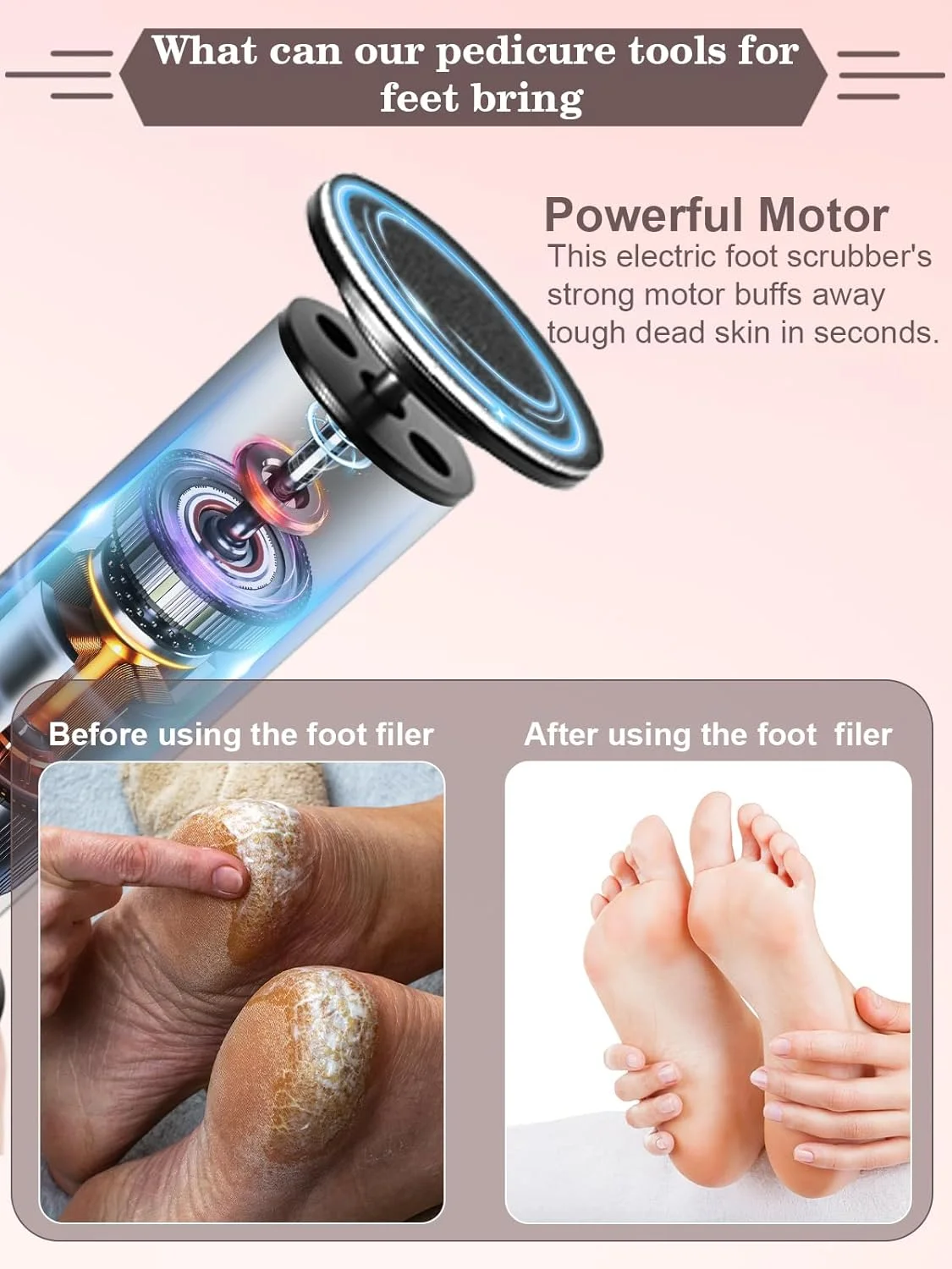 سوهان برقی پا MOWLIE، ابزار مراقبت از پا برقی با کنترل کننده سرعت و 60 عدد دیسک سمباده جایگزین برای از بین بردن پینه، پوست خشک و ترک خورده (مشکی) سوهان برقی پا MOWLIE، ابزار مراقبت از پا برقی با کنترل کننده سرعت و 60 عدد دیسک سمباده جایگزین برای از بین بردن پینه، پوست خشک و ترک خورده (مشکی)