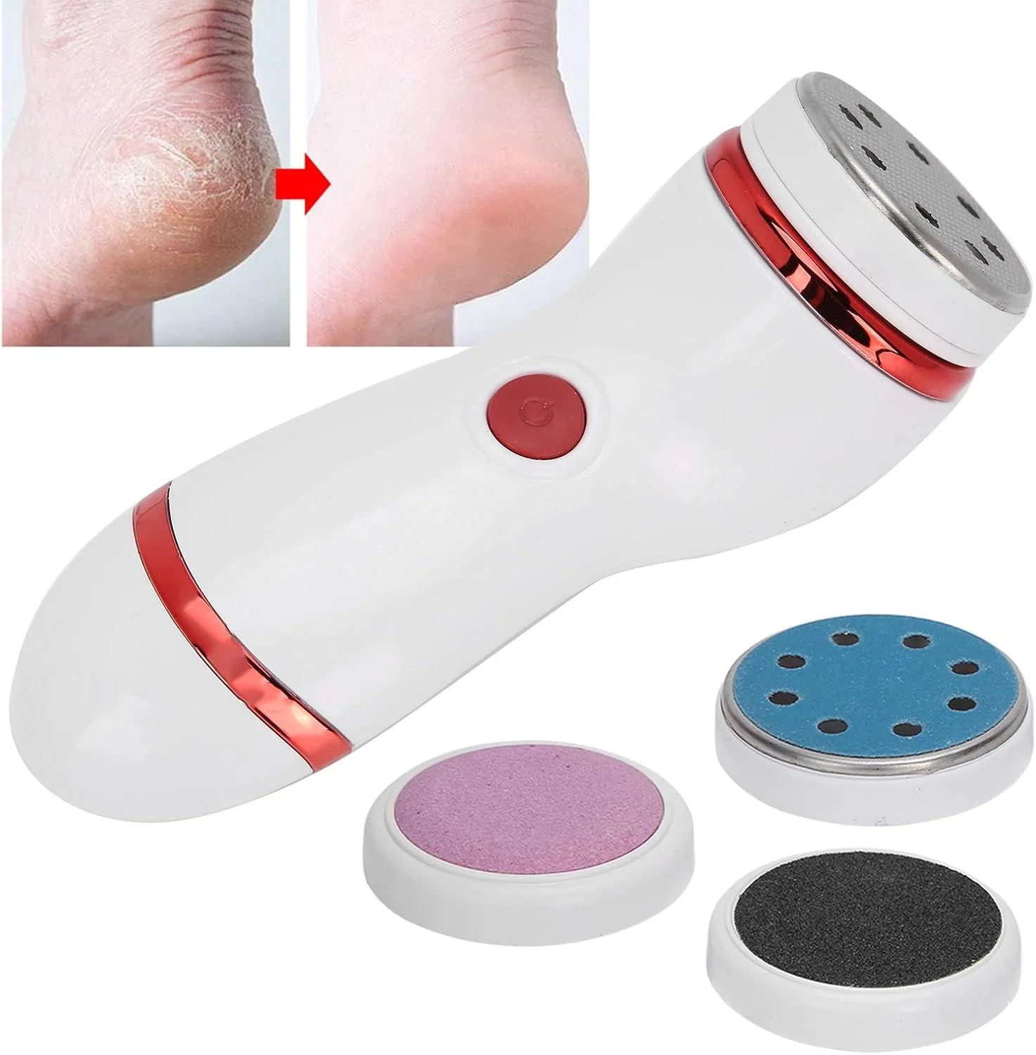 کیت سوهان برقی پا با 4 سری سمباده، قابل حمل و ضد آب، از بین برنده پوست خشک، سخت و ترک خورده، پینه ها، بهترین ابزار پدیکور و مراقبت از پا کیت سوهان برقی پا با 4 سری سمباده، قابل حمل و ضد آب، از بین برنده پوست خشک، سخت و ترک خورده، پینه ها، بهترین ابزار پدیکور و مراقبت از پا