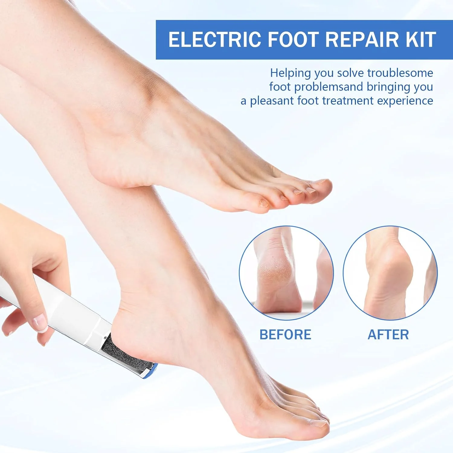 سوهان برقی پا، سوهان برقی بهبود یافته 2025، پدیکور قابل شارژ، مناسب برای مراقبت روزانه از پا (آبی)