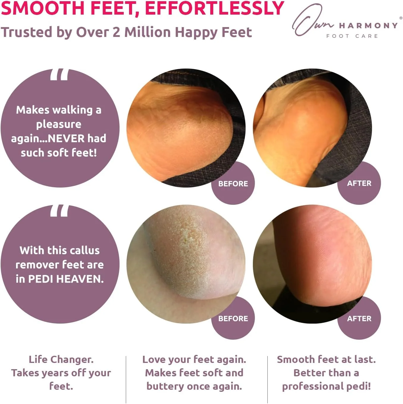 سوهان برقی پدیکور پا شارژی: ابزار حرفه ای پدیکور اون هارمونی (طراحی 2020) بهترین دستگاه سمباده برقی پا، پدی عالی برای از بین بردن پوست سفت، پینه و ترک پاشنه پا