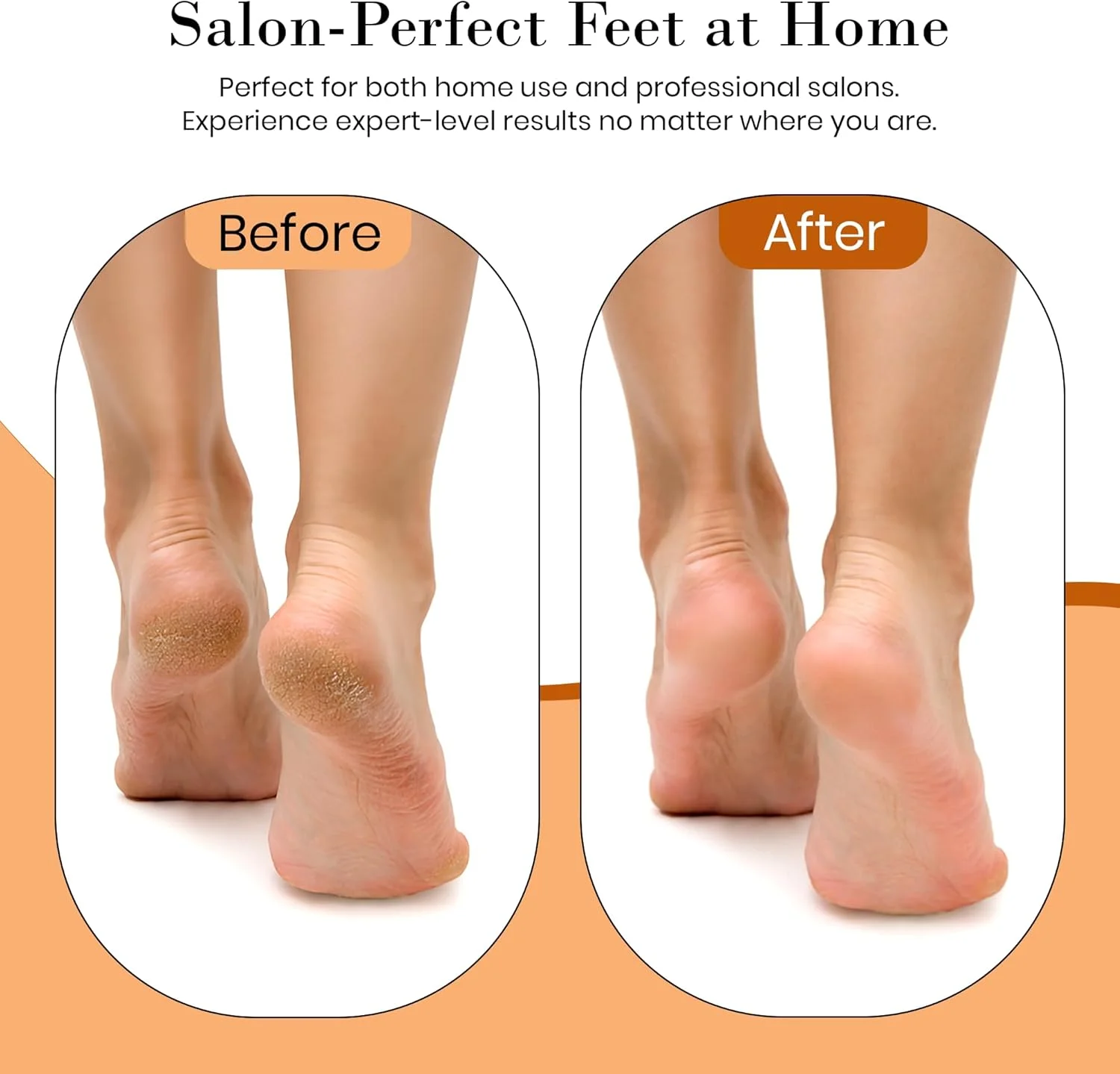 سوهان برقی پا برای از بین بردن پینه - سوهان پدیکور با سرعت قابل تنظیم برای پوست های سخت - سوهان برقی از بین برنده پوست مرده، ترک پاشنه و پینه - ست بادوام پدیکور پا