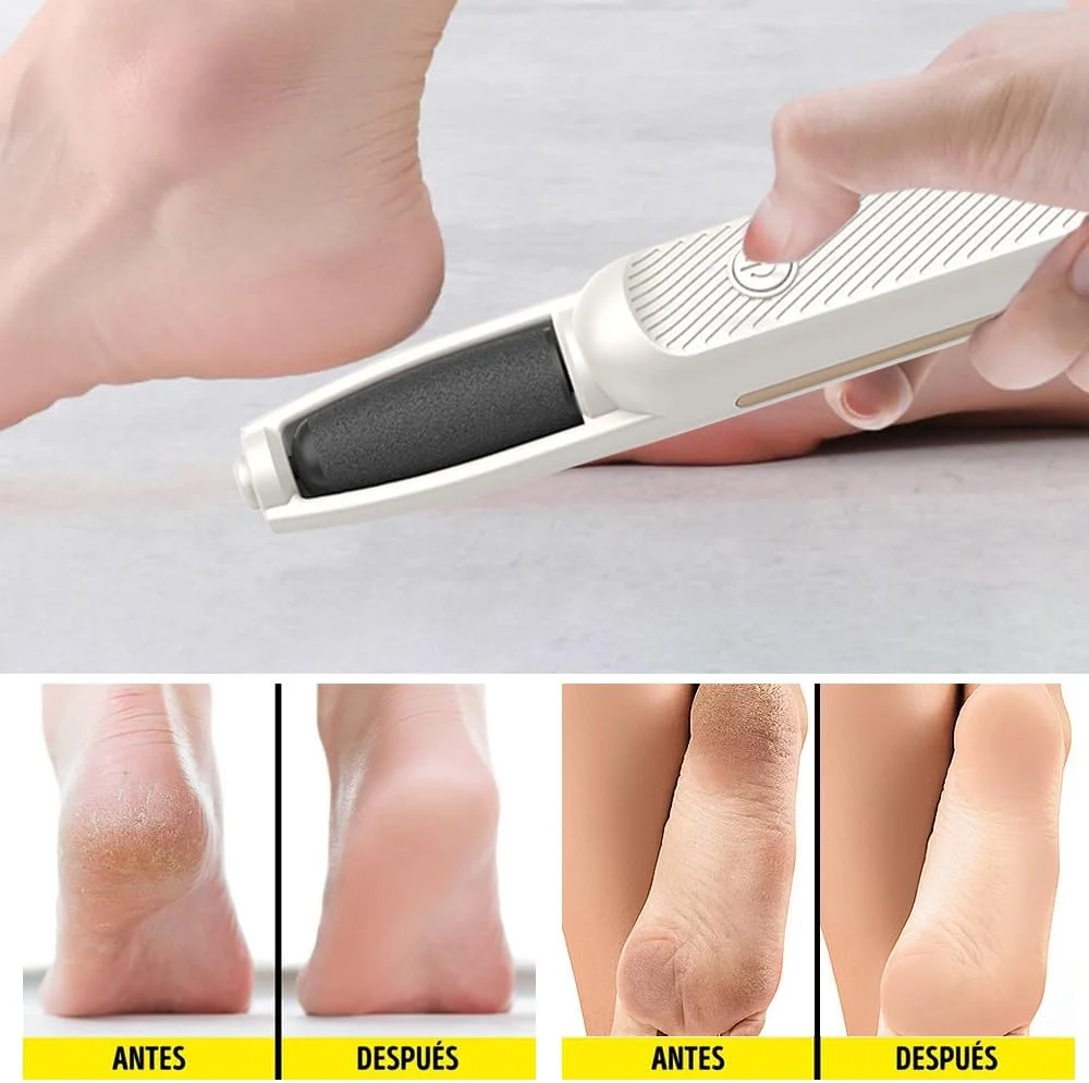 سوهان برقی پینه پا، سوهان برقی پینه 2025، از بین برنده برقی پینه، سوهان شارژی پا برای پوست های مرده (سفید شیری) سوهان برقی پینه پا، سوهان برقی پینه 2025، از بین برنده برقی پینه، سوهان شارژی پا برای پوست های مرده (سفید شیری)