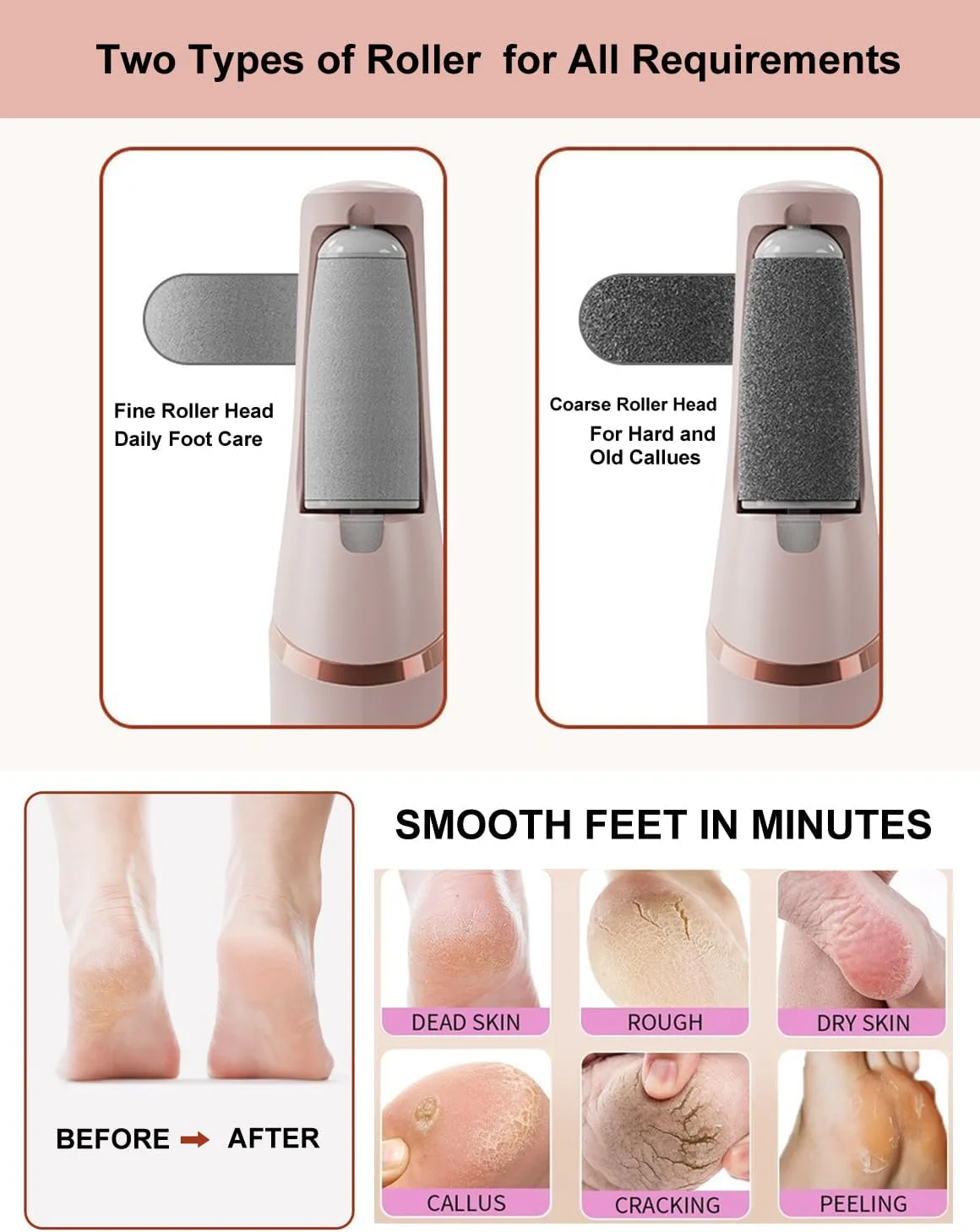 سوهان برقی پا، سوهان شارژی پا - دارای 2 سرعت قابل تنظیم، غلتک زبر و نرم - از بین بردن پوست سفت پا به صورت برقی - پاهایی صاف در چند ثانیه برای خانم ها و آقایان (سفید) سوهان برقی پا، سوهان شارژی پا - دارای 2 سرعت قابل تنظیم، غلتک زبر و نرم - از بین بردن پوست سفت پا به صورت برقی - پاهایی صاف در چند ثانیه برای خانم ها و آقایان (سفید)