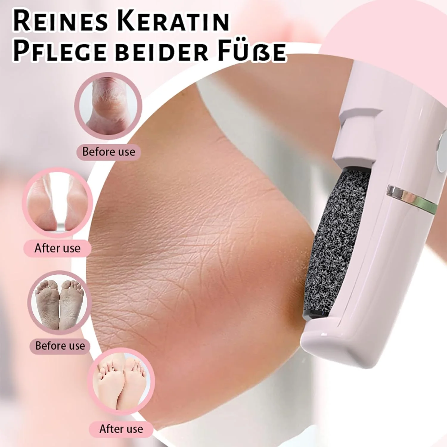 سوهان برقی پدیکور پا مدل 2025، دستگاه مراقبت از پا، سنگ پای برقی، از بین برنده پینه برقی پا، مناسب برای پوست های مرده، ضخیم و خشک پاشنه پا (صورتی)
