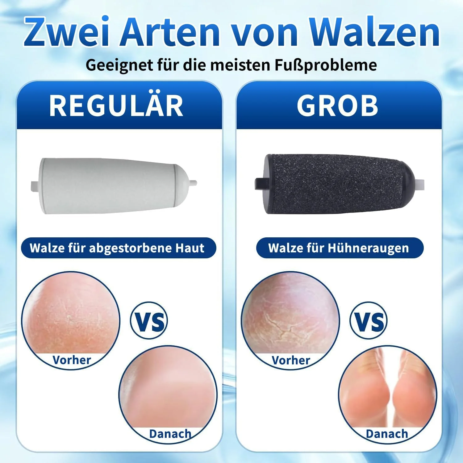 سوهان برقی پا، ست پدیکور قوی، سوهان برقی مراقبت از پا برای پوست های مرده، سخت و ترک خورده (آبی)