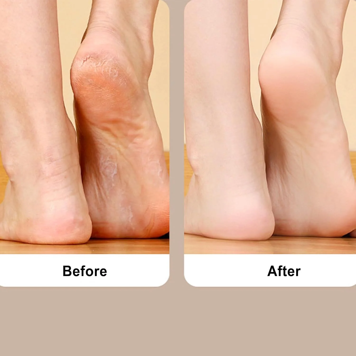 سوهان برقی پدیکور پا | دستگاه سنگ پا برقی - ابزار اسکرابر پدیکور با محفظه تمیز کننده UV داخلی برای بزرگسالان، سالمندان، زنان و مردان سوهان برقی پدیکور پا | دستگاه سنگ پا برقی - ابزار اسکرابر پدیکور با محفظه تمیز کننده UV داخلی برای بزرگسالان، سالمندان، زنان و مردان