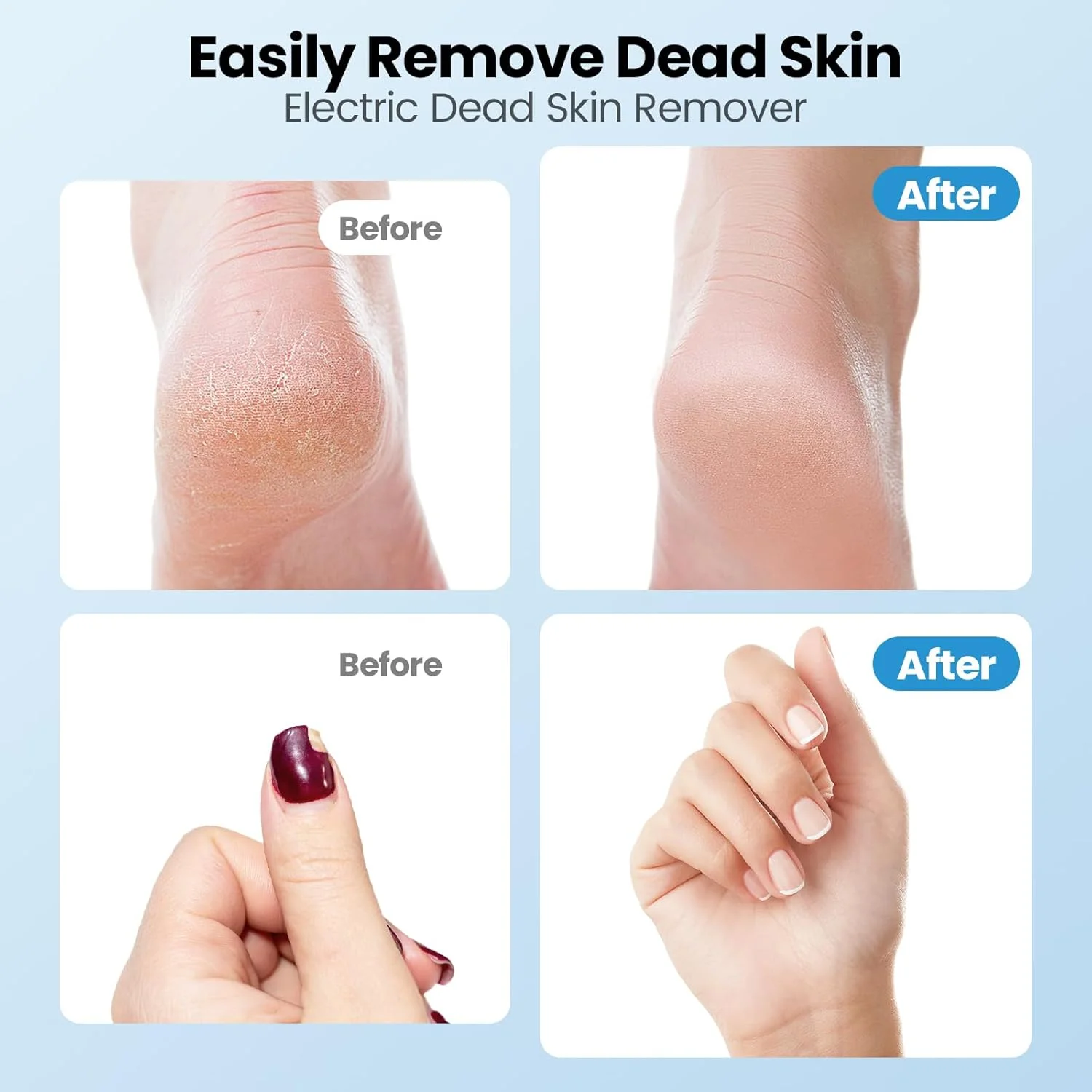 سوهان برقی پینه پا، دستگاه سنگ پای برقی 2 در 1، اسکرابر شارژی و بی سیم پا برای پوست های مرده، سرعت قابل تنظیم با دیسک های سمباده ای، ابزار حرفه ای پدیکور، صورتی سوهان برقی پینه پا، دستگاه سنگ پای برقی 2 در 1، اسکرابر شارژی و بی سیم پا برای پوست های مرده، سرعت قابل تنظیم با دیسک های سمباده ای، ابزار حرفه ای پدیکور، صورتی