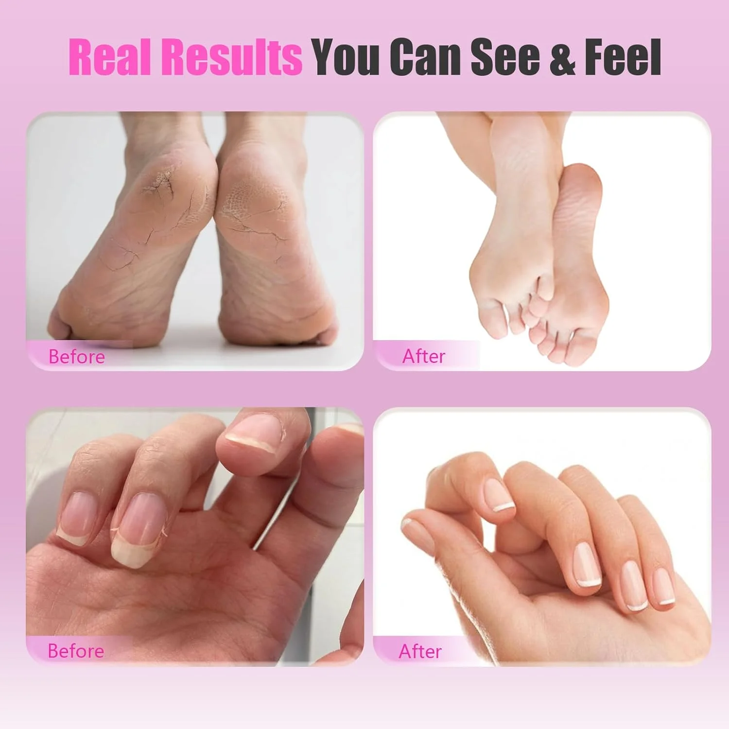 سوهان برقی پینه پا - سوهان پای شارژی 2 در 1 با دیسک های سمباده، سری های دریل ناخن، سرعت قابل تنظیم، نمایشگر LED، ابزار حرفه ای پدیکور برای داشتن پاهایی صاف و لطیف در هر زمان و مکان سوهان برقی پینه پا - سوهان پای شارژی 2 در 1 با دیسک های سمباده، سری های دریل ناخن، سرعت قابل تنظیم، نمایشگر LED، ابزار حرفه ای پدیکور برای داشتن پاهایی صاف و لطیف در هر زمان و مکان