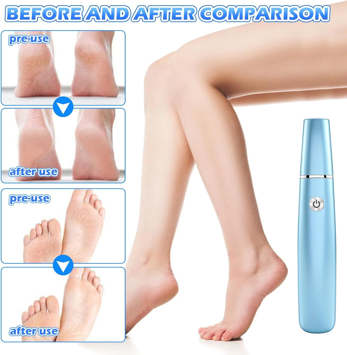 سوهان برقی پدیکور پا، سوهان برقی پا، سوهان برقی اتوماتیک، سوهان پا برای انگشتان پا، پاشنه، کناره پا و کف پا