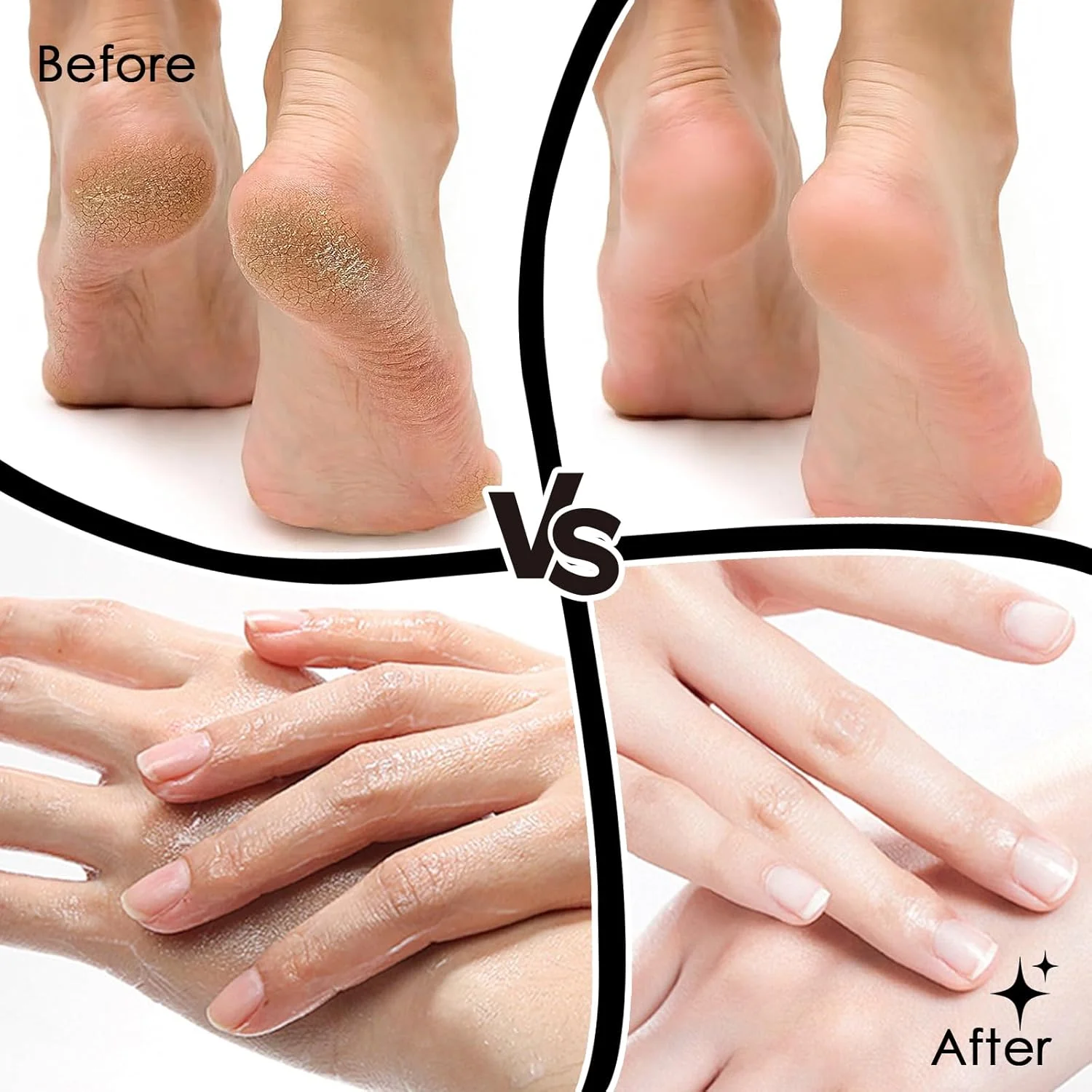 سوهان برقی پدیکور 2 در 1، مجموعه فایل پدیکور حرفه ای با سرعت قابل تنظیم برای پوست های مرده، سخت و ترک خورده، سوهان برقی شارژی پا (نقره ای)