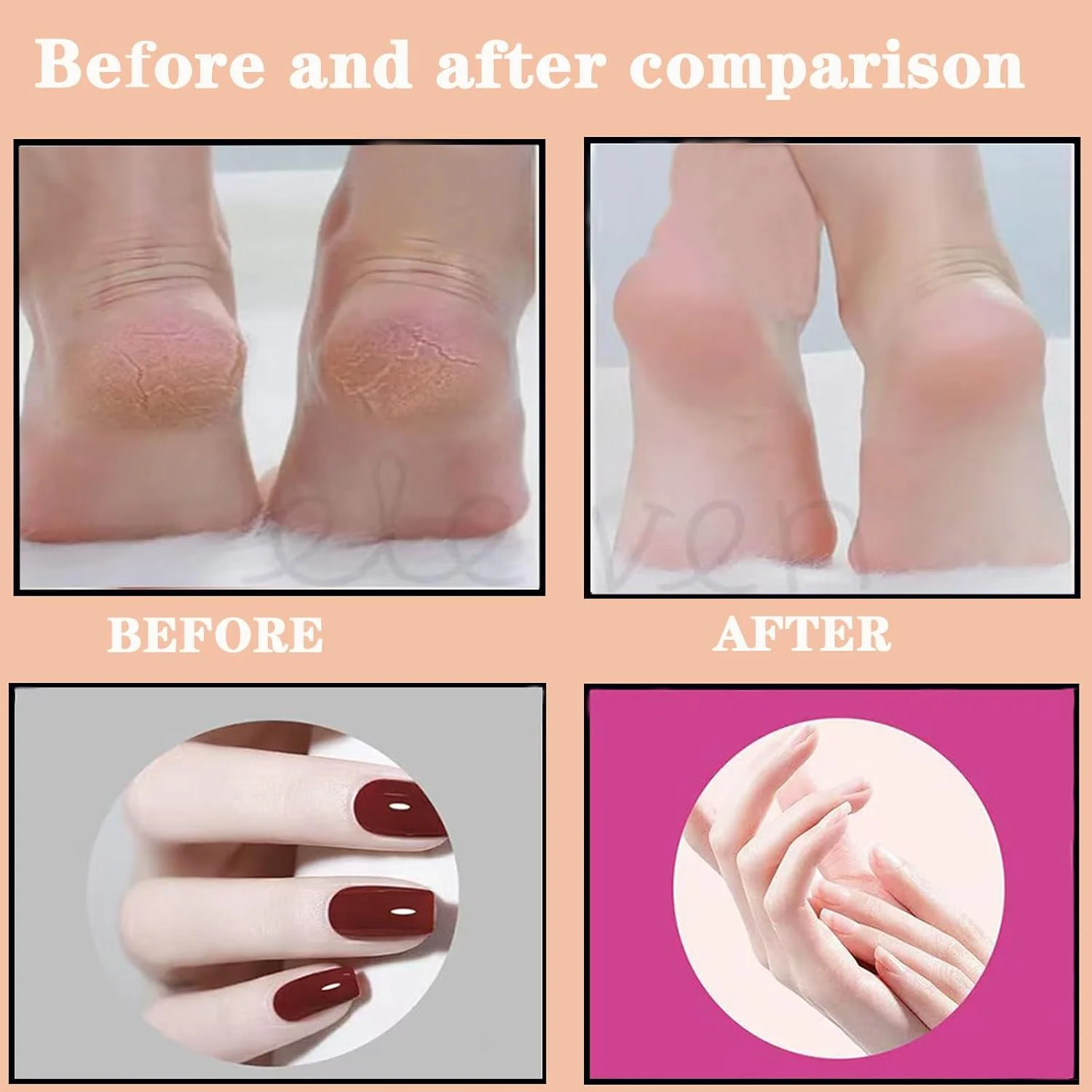 سوهان برقی پدیکور دارماوه، ابزار پدیکور 2 در 1 با سرعت قابل تنظیم و شارژی برای از بین بردن پوست مرده پا، به همراه دیسک سمباده و سری های سوهان ناخن، مجهز به صفحه نمایش دیجیتال