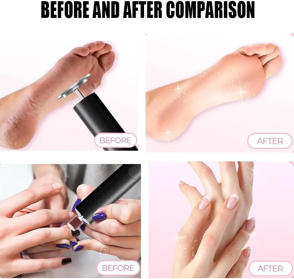 سوهان برقی پدیکور دکتر پدی بی سیم برای پا با سوهان ناخن 2 در 1، دستگاه سنگ پا برقی قابل شارژ برای ترک خوردگی پوست مرده و پینه های خشک به همراه دیسک سمباده ای و 6 سرعت قابل تنظیم سوهان برقی پدیکور دکتر پدی بی سیم برای پا با سوهان ناخن 2 در 1، دستگاه سنگ پا برقی قابل شارژ برای ترک خوردگی پوست مرده و پینه های خشک به همراه دیسک سمباده ای و 6 سرعت قابل تنظیم