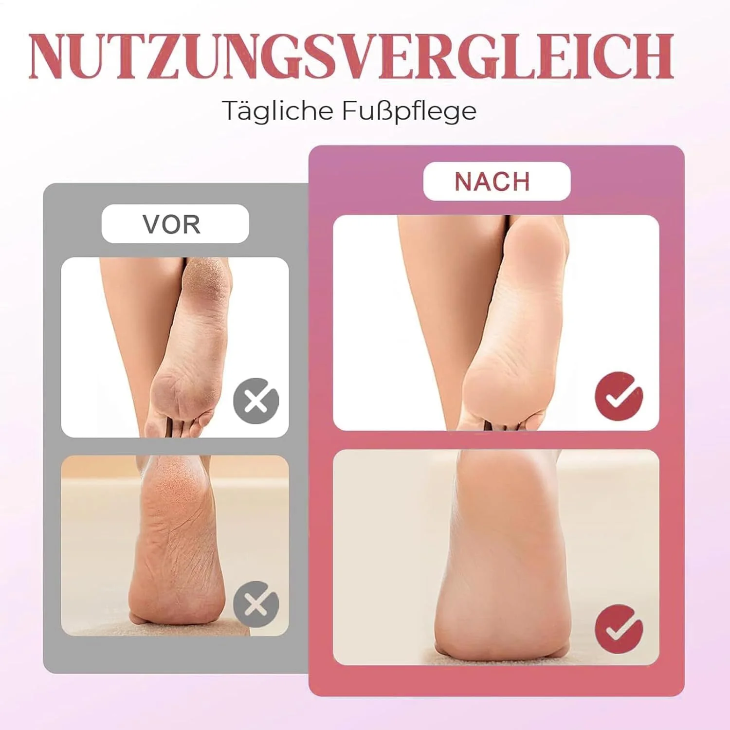 سوهان برقی پدیکور پا، ابزار پدیکور برقی پا، کیت پدیکور سنگ پا شارژی برای زنان و مردان، مراقبت از پاشنه پا برای پوست های سخت، زبر، ترک خورده و مرده سوهان برقی پدیکور پا، ابزار پدیکور برقی پا، کیت پدیکور سنگ پا شارژی برای زنان و مردان، مراقبت از پاشنه پا برای پوست های سخت، زبر، ترک خورده و مرده