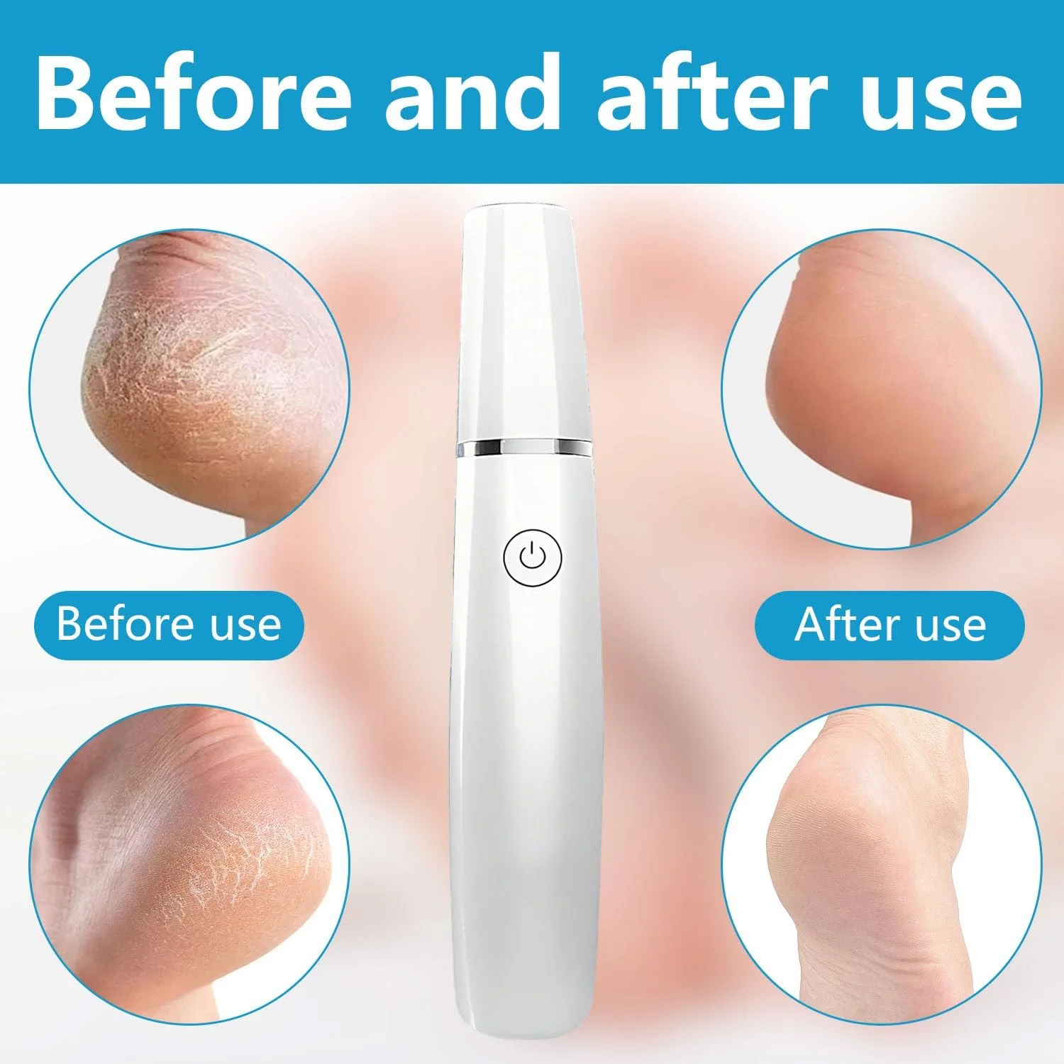 ست حرفه ای پدیکور برقی، سوهان پدیکور برقی پا به همراه غلطک های تعویضی ست حرفه ای پدیکور برقی، سوهان پدیکور برقی پا به همراه غلطک های تعویضی