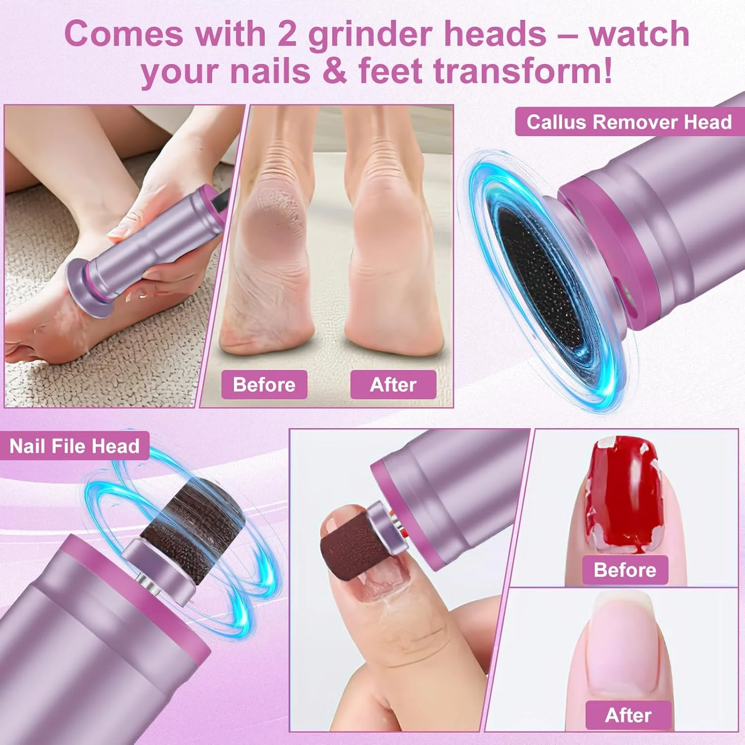 سوهان برقی پا، ست سوهان پدیکور 2 در 1، سرعت قابل تنظیم، پدیکور حرفه ای برای پاشنه های ترک خورده، پینه و پوست مرده (صورتی) سوهان برقی پا، ست سوهان پدیکور 2 در 1، سرعت قابل تنظیم، پدیکور حرفه ای برای پاشنه های ترک خورده، پینه و پوست مرده (صورتی)