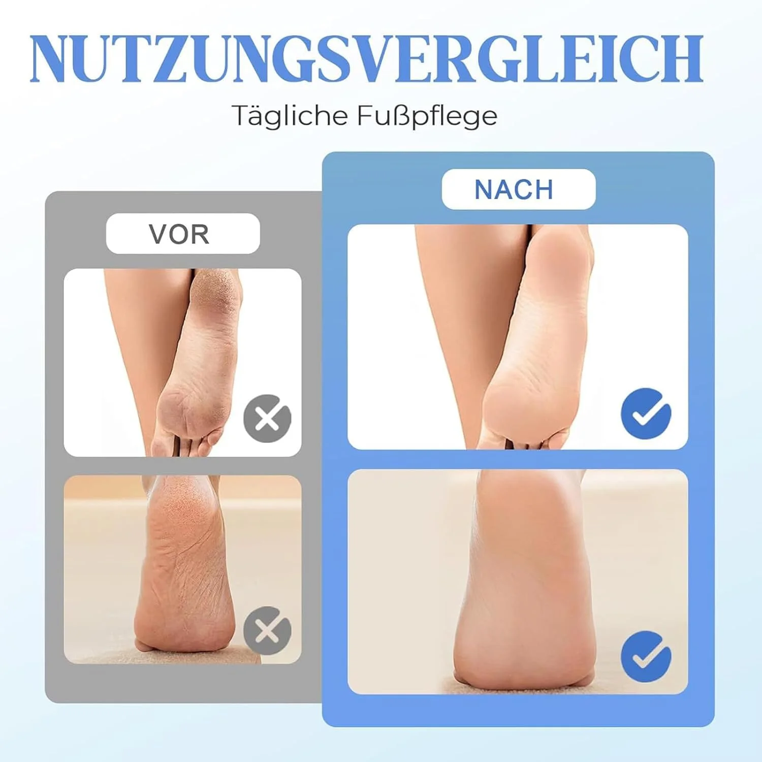 سوهان برقی پدیکور پا، ابزار برقی از بین برنده پینه پا | کیت پدیکور اسکرابر سنگ پا شارژی برای مراقبت از پاشنه پا، پوست های سفت، زبر، ترک خورده و مرده برای زنان و مردان