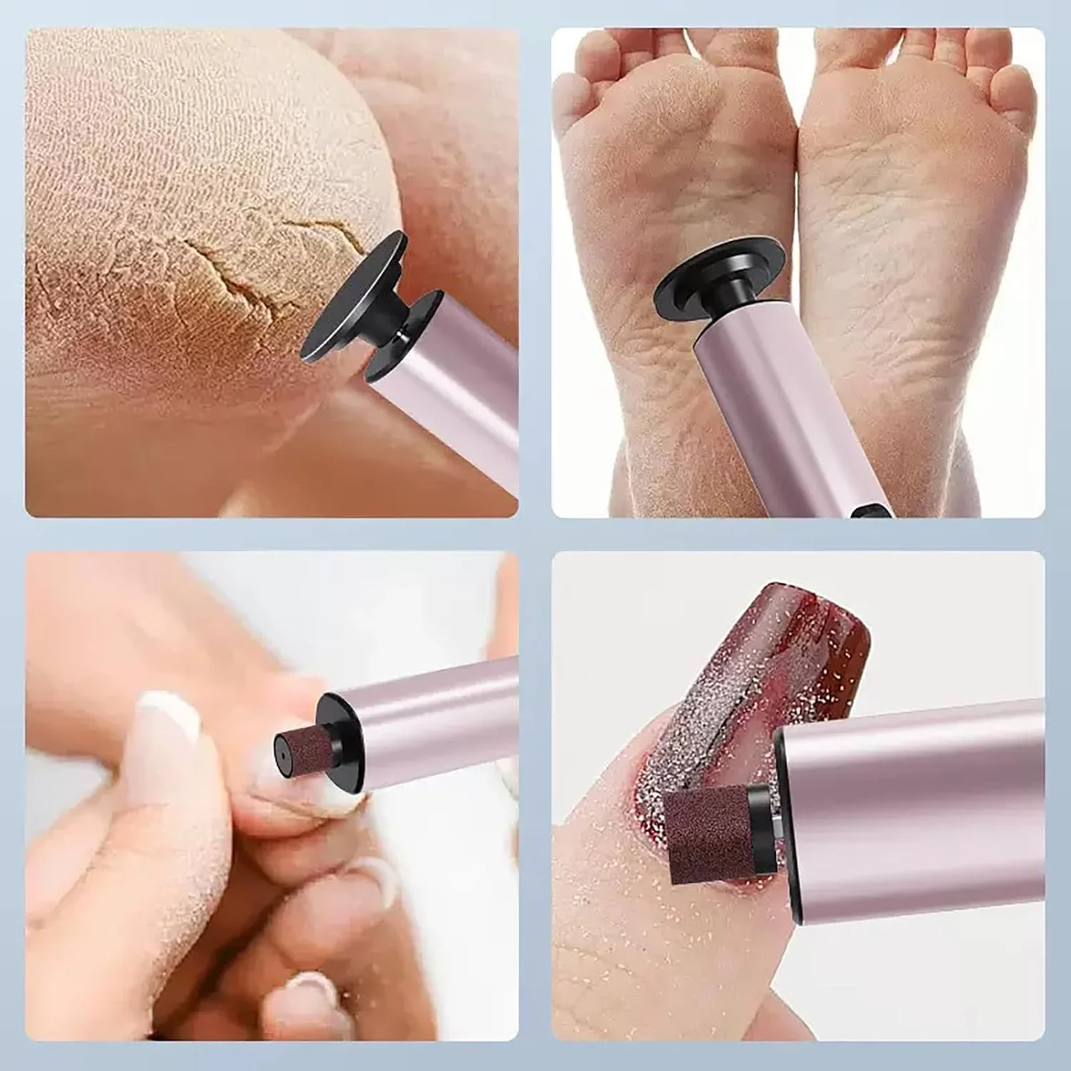 Callus Remover for Feet Electric Foot File Rechargeable Portable Pedicure Tools Dead Skin Remover Feet Care for Dead Hard Cracked Dry Skin