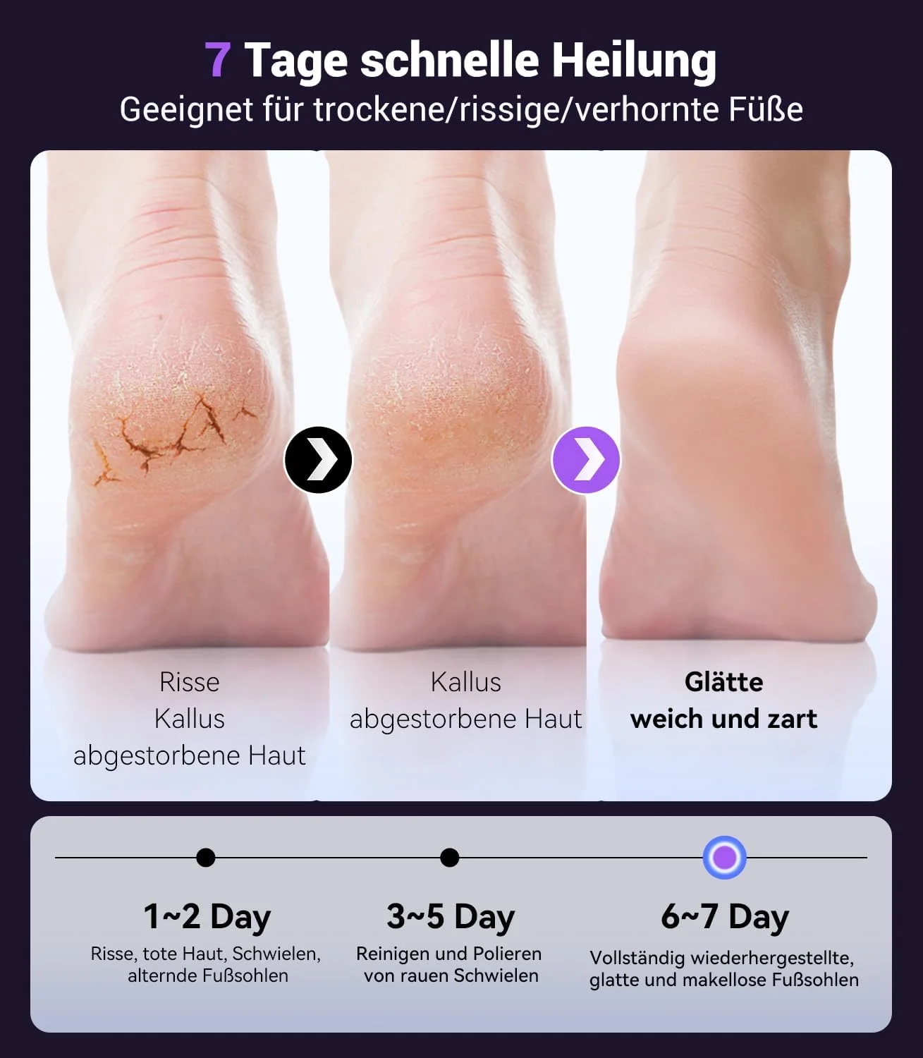 سوهان برقی پدیکور 5 در 1، از بین برنده 99.92% پینه در 3 دقیقه، سوهان برقی پا، فناوری حسگر پا، مناسب برای پوست های ترک خورده و سخت (بنفش) سوهان برقی پدیکور 5 در 1، از بین برنده 99.92% پینه در 3 دقیقه، سوهان برقی پا، فناوری حسگر پا، مناسب برای پوست های ترک خورده و سخت (بنفش)