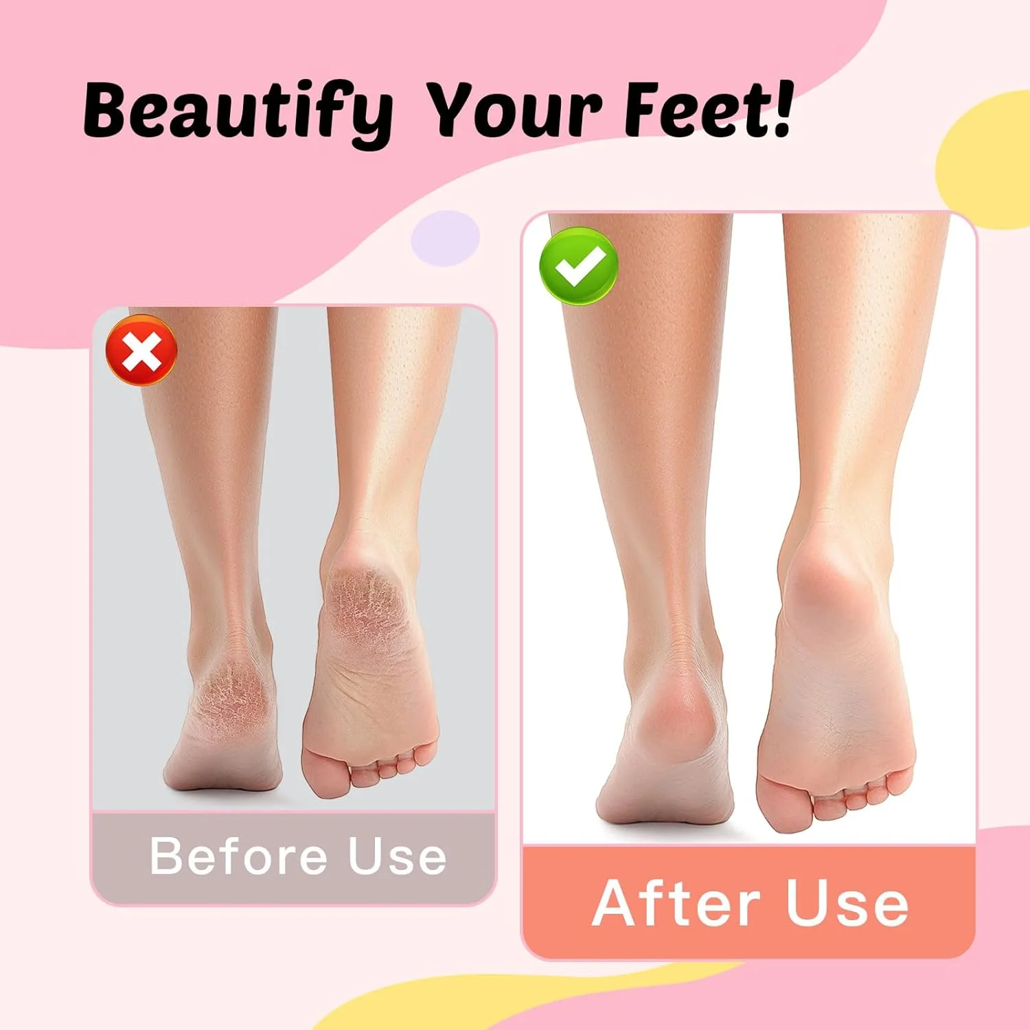 سوهان برقی پدیکور و سوهان ناخن Dolcevitae - سوهان برقی پا، 9 سرعت قابل تنظیم، باتری قابل شارژ 1800mAh، بدنه آلومینیومی قابل حمل با شارژ Type-C برای خانه و مسافرت (مشکی) سوهان برقی پدیکور و سوهان ناخن Dolcevitae - سوهان برقی پا، 9 سرعت قابل تنظیم، باتری قابل شارژ 1800mAh، بدنه آلومینیومی قابل حمل با شارژ Type-C برای خانه و مسافرت (مشکی)