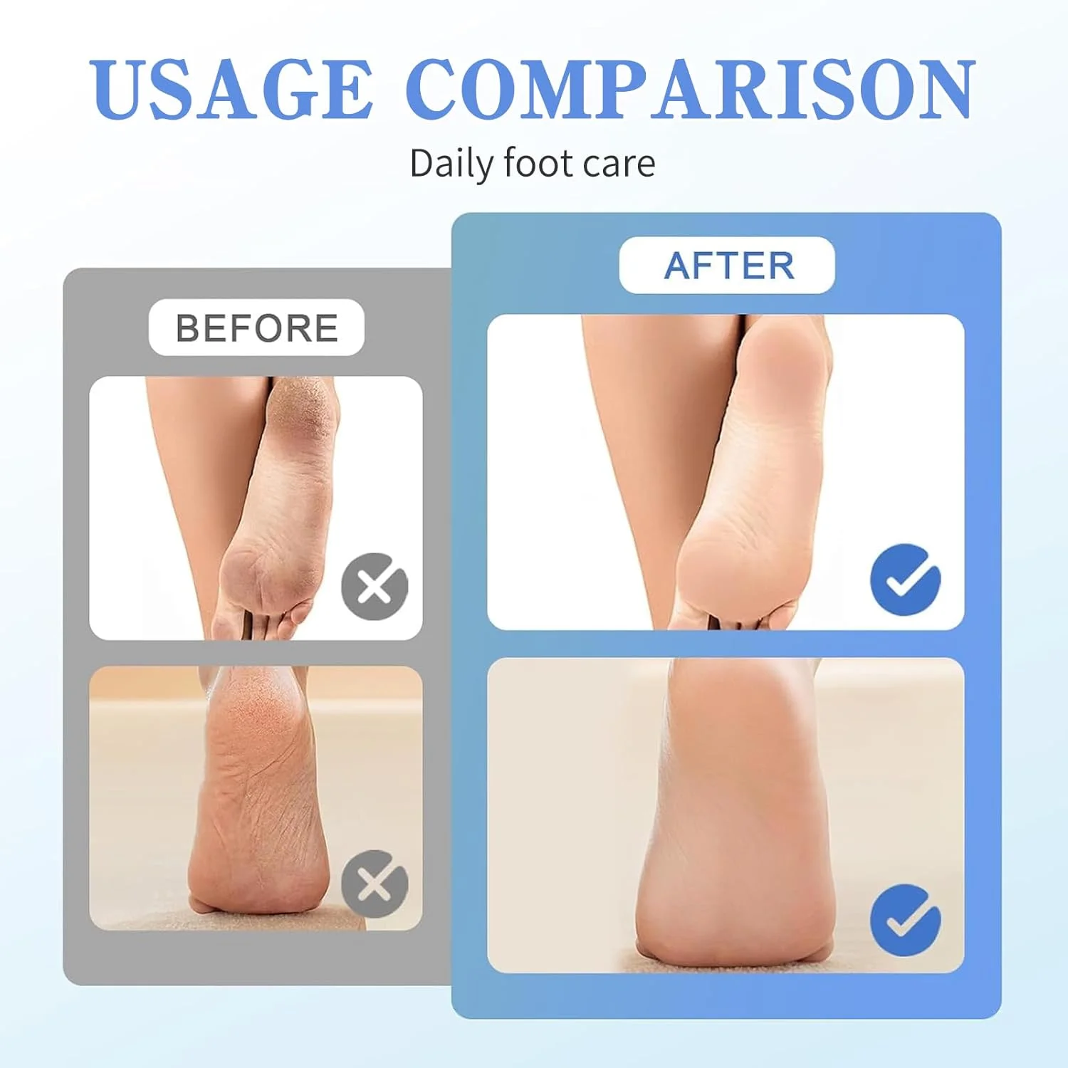 سوهان برقی پا برای از بین بردن پینه