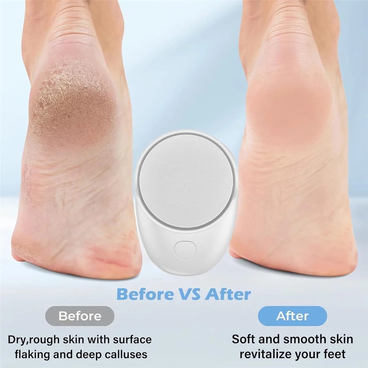 مینی سنگ پای برقی قابل حمل، سوهان پدیکور برقی شارژی USB با 2 سری سنگ زنی، فایل پدیکور الکترونیکی دو سرعته برای ترمیم پاشنه پا، ابزار مراقبت از پوست های مرده، سفت و خشک ترک خورده
