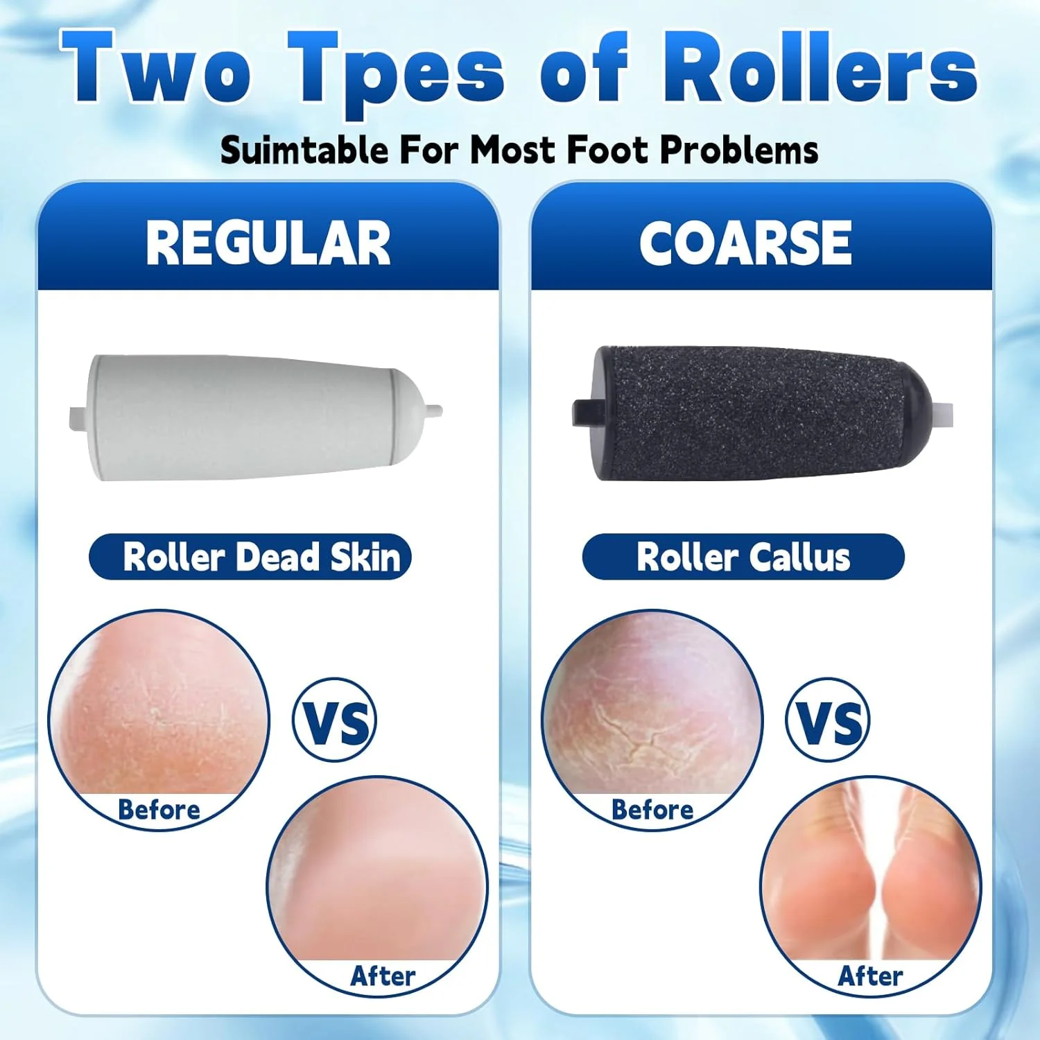 سوهان برقی پینه پا دندین، سوهان برقی پا، ست پدیکور، مراقبت برقی پا، از بین بردن پینه پا، از بین بردن برقی پینه پا، برای پوست های مرده، سخت و ترک خورده