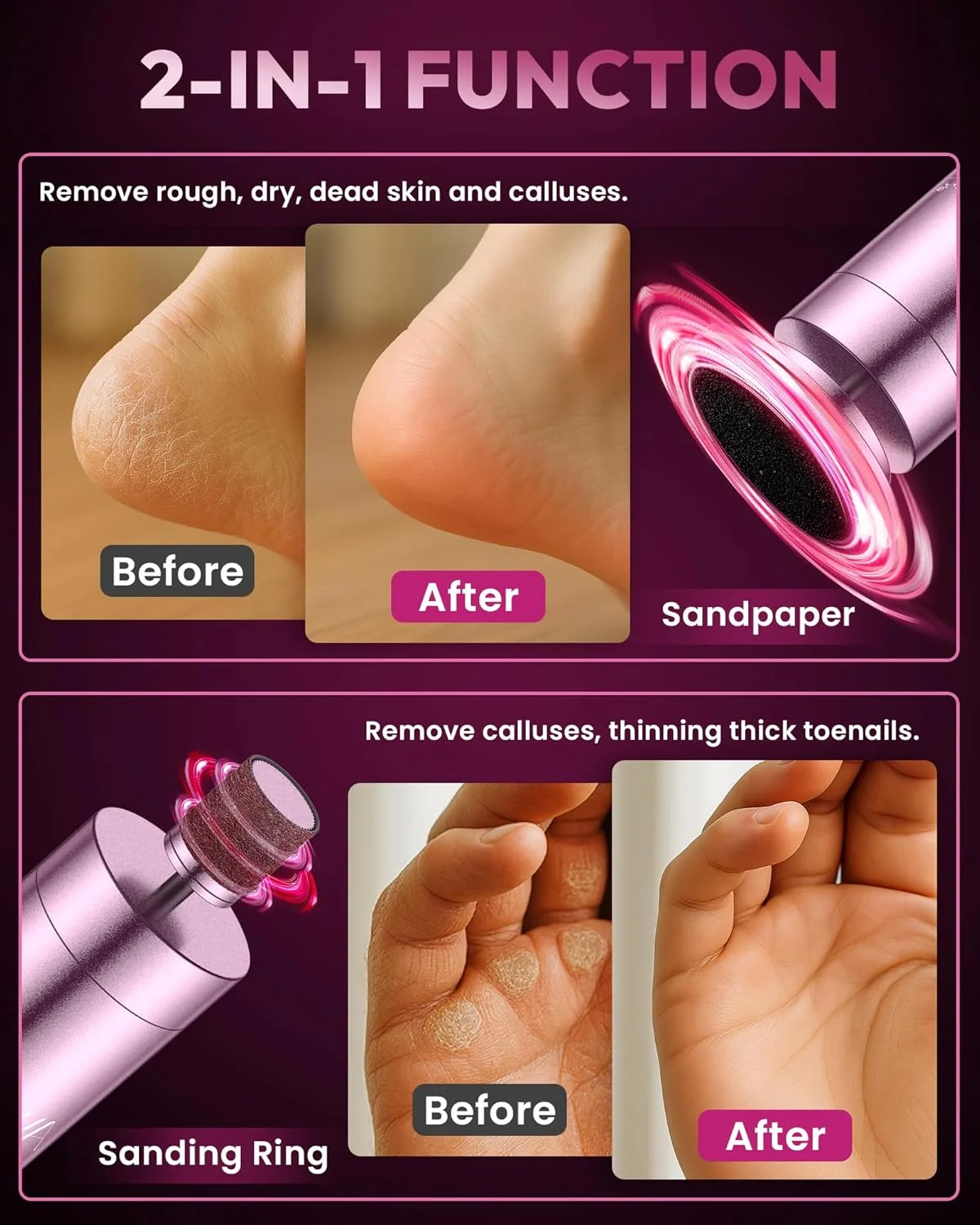 سوهان پدیکور پا آو رز، سوهان برقی بدون سیم پا با باتری قابل شارژ 2600 میلی آمپر ساعتی، سوهان آلومینیومی 6.2 اینچی، ابزار حرفه ای پدیکور برای پوست های مرده/سخت/خشک و پاشنه های ترک خورده سوهان پدیکور پا آو رز، سوهان برقی بدون سیم پا با باتری قابل شارژ 2600 میلی آمپر ساعتی، سوهان آلومینیومی 6.2 اینچی، ابزار حرفه ای پدیکور برای پوست های مرده/سخت/خشک و پاشنه های ترک خورده