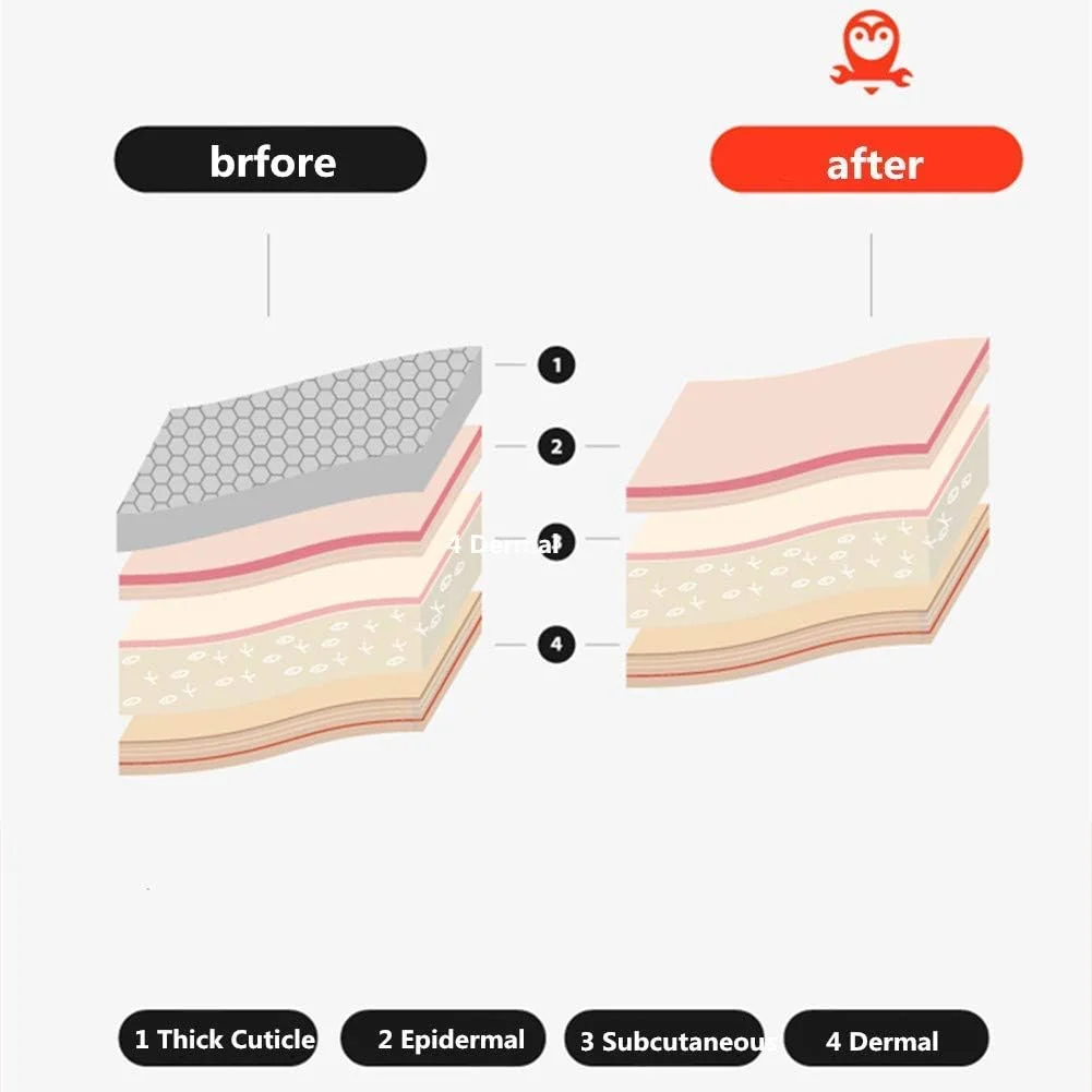 CHOUJU Callus Remover Electric Rasp Foot Care Automatic Peeling Grinding Dead Skin Machine for Feet and Hands File CHOUJU Callus Remover Electric Rasp Foot Care Automatic Peeling Grinding Dead Skin Machine for Feet and Hands File