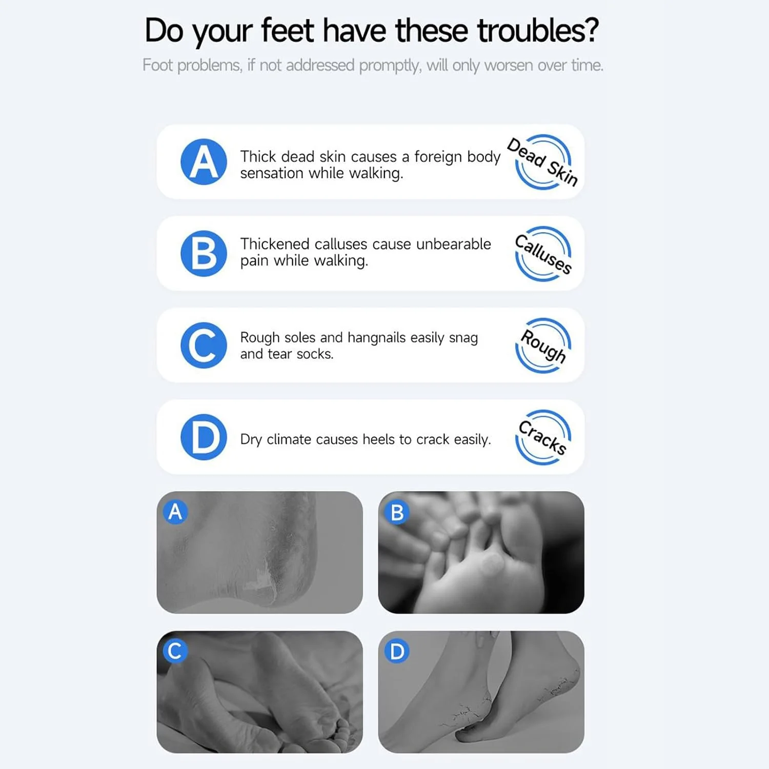 سوهان برقی پینه پا، سوهان برقی پینه پا | اسکرابر حرفه ای برقی قابل شارژ، ابزار پدیکور پوست مرده خشک برای مسافرت و خانه سوهان برقی پینه پا، سوهان برقی پینه پا | اسکرابر حرفه ای برقی قابل شارژ، ابزار پدیکور پوست مرده خشک برای مسافرت و خانه