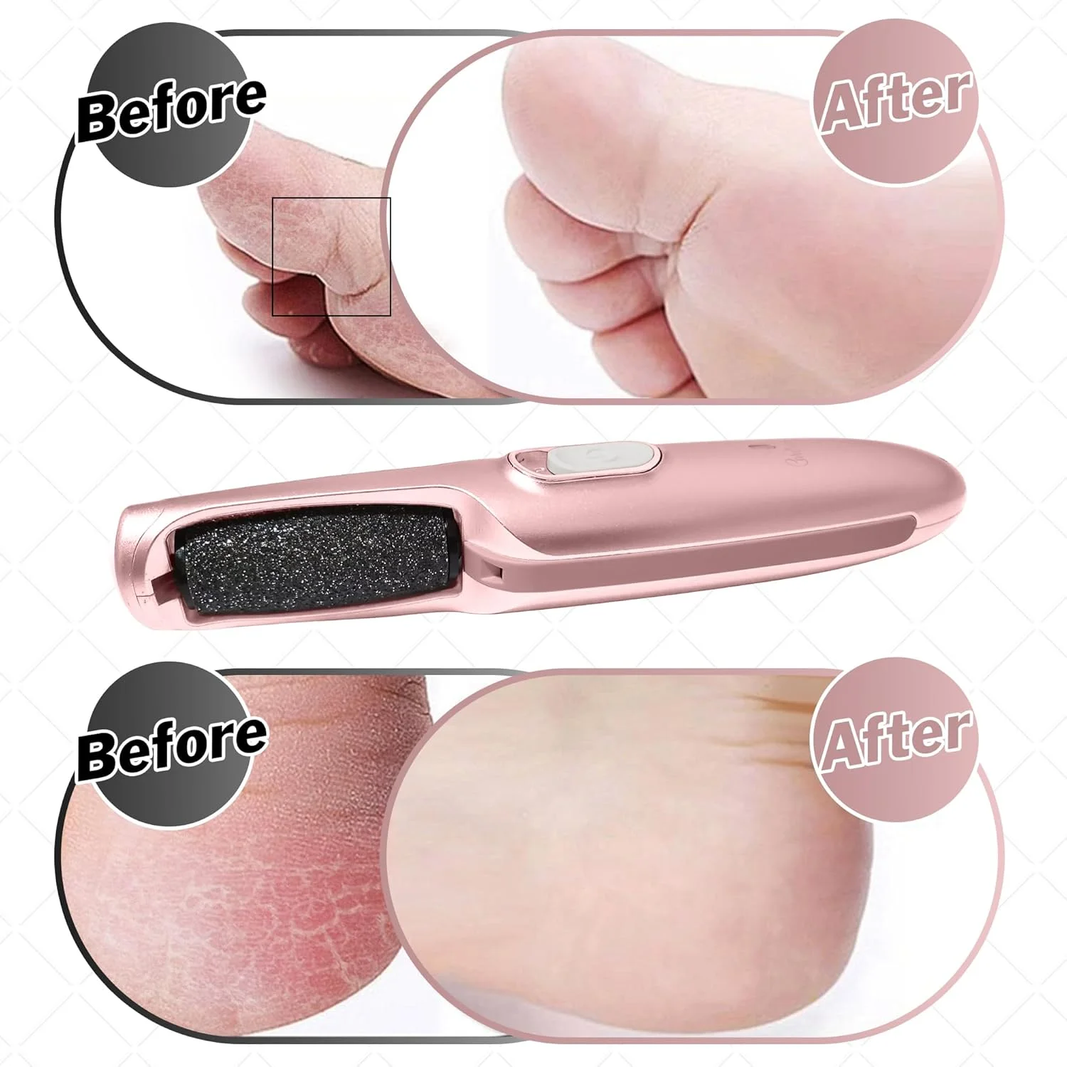 سوهان برقی قدرتمند و شارژی از برند Care me برای از بین بردن پینه پا