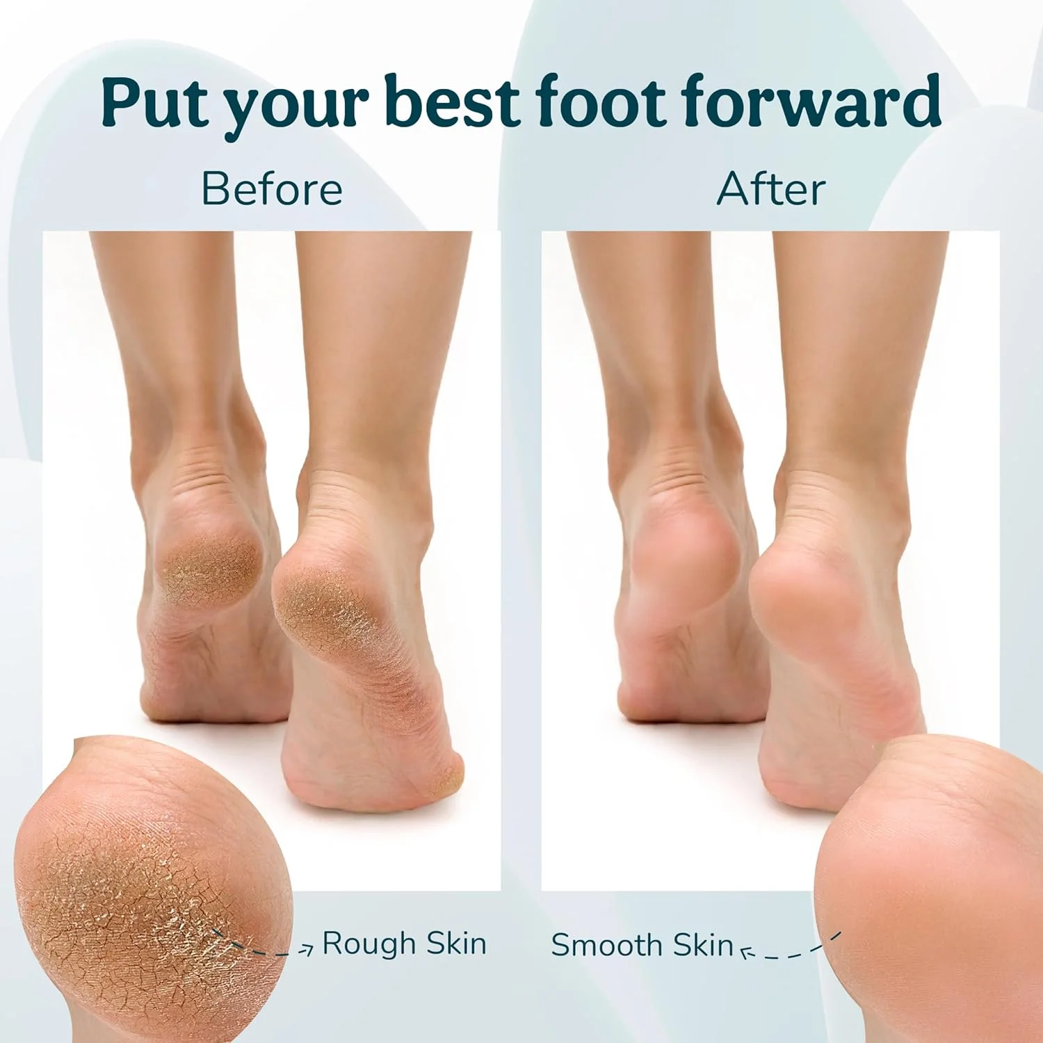 سوهان پدیکور برقی Caresmith Bloom برای از بین بردن پوست مرده | دارای 3 سری کریستال کوارتز مناسب برای از بین بردن پوست مرده | کیت پدیکور برای زنان به عنوان پاک کننده پا سوهان پدیکور برقی Caresmith Bloom برای از بین بردن پوست مرده | دارای 3 سری کریستال کوارتز مناسب برای از بین بردن پوست مرده | کیت پدیکور برای زنان به عنوان پاک کننده پا