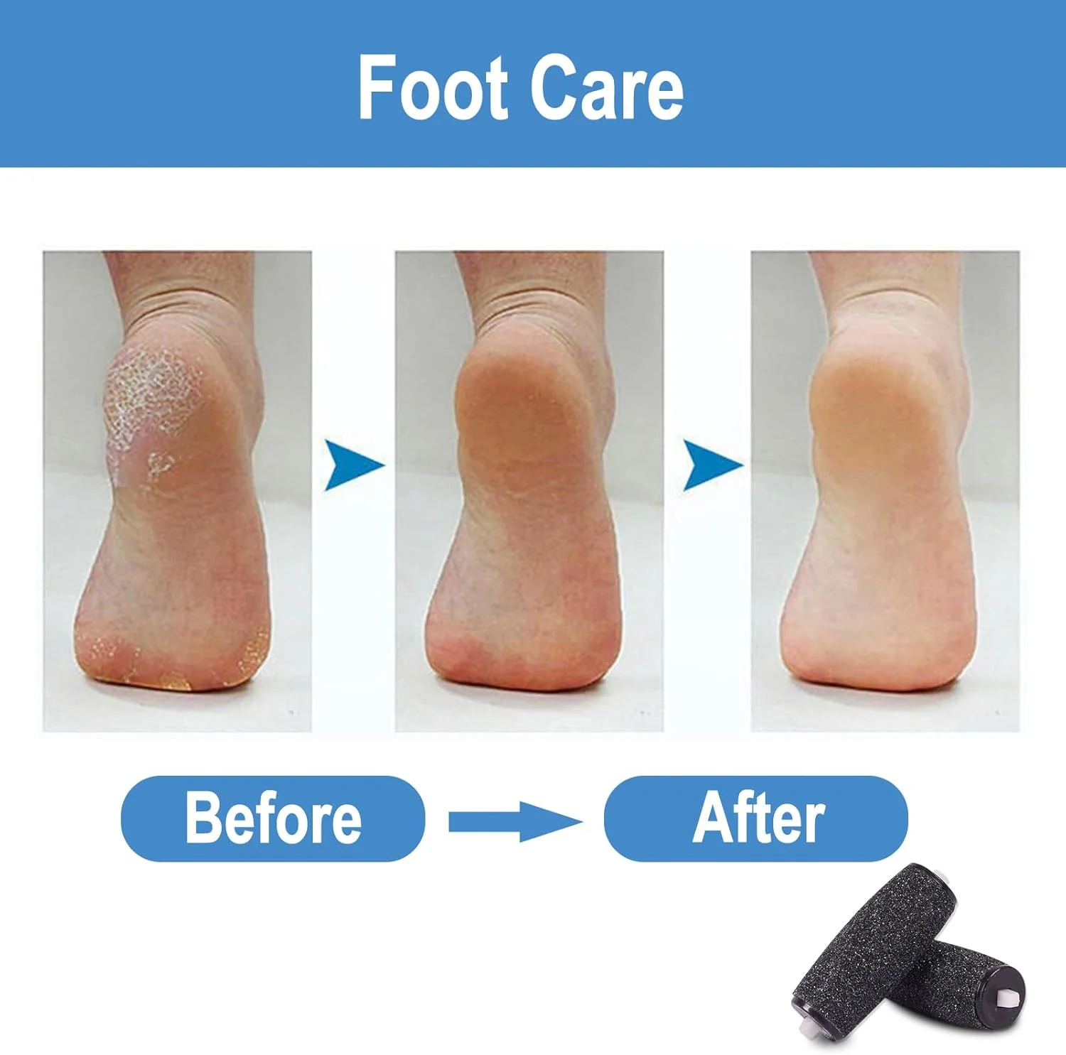 12 PCS Callus Remover Replacement Rollers, Electric Callus Remover Rollers for Electric Callus Remover Ideal for Foot Care 12 PCS Callus Remover Replacement Rollers, Electric Callus Remover Rollers for Electric Callus Remover Ideal for Foot Care