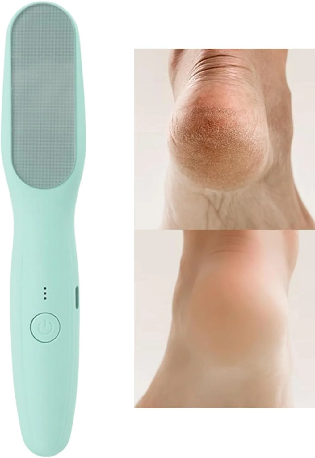 سوهان برقی پدیکور پا - سوهان برقی پا - ست پدیکور با سرعت قابل تنظیم، ضد آب، مناسب برای مراقبت از پا در منزل، سالن، استفاده روزانه، مسافرت، آقایان و بانوان