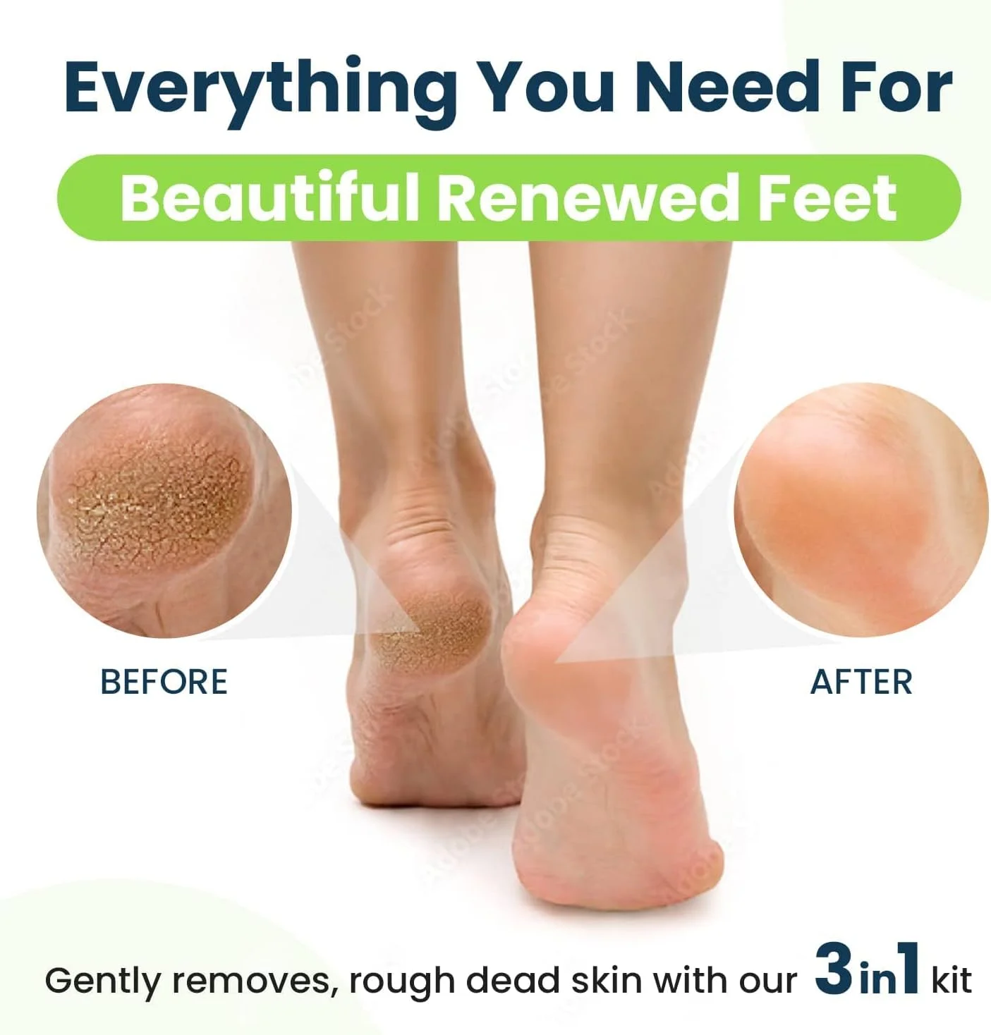 از بین برنده پینه پا همراه با ژل قوی و سنگ پا - راهی آسان برای از بین بردن پینه های سخت و پوست مرده - مراقبت حرفه ای از پا در خانه برای آقایان و خانم ها - ساخت آمریکا از بین برنده پینه پا همراه با ژل قوی و سنگ پا - راهی آسان برای از بین بردن پینه های سخت و پوست مرده - مراقبت حرفه ای از پا در خانه برای آقایان و خانم ها - ساخت آمریکا